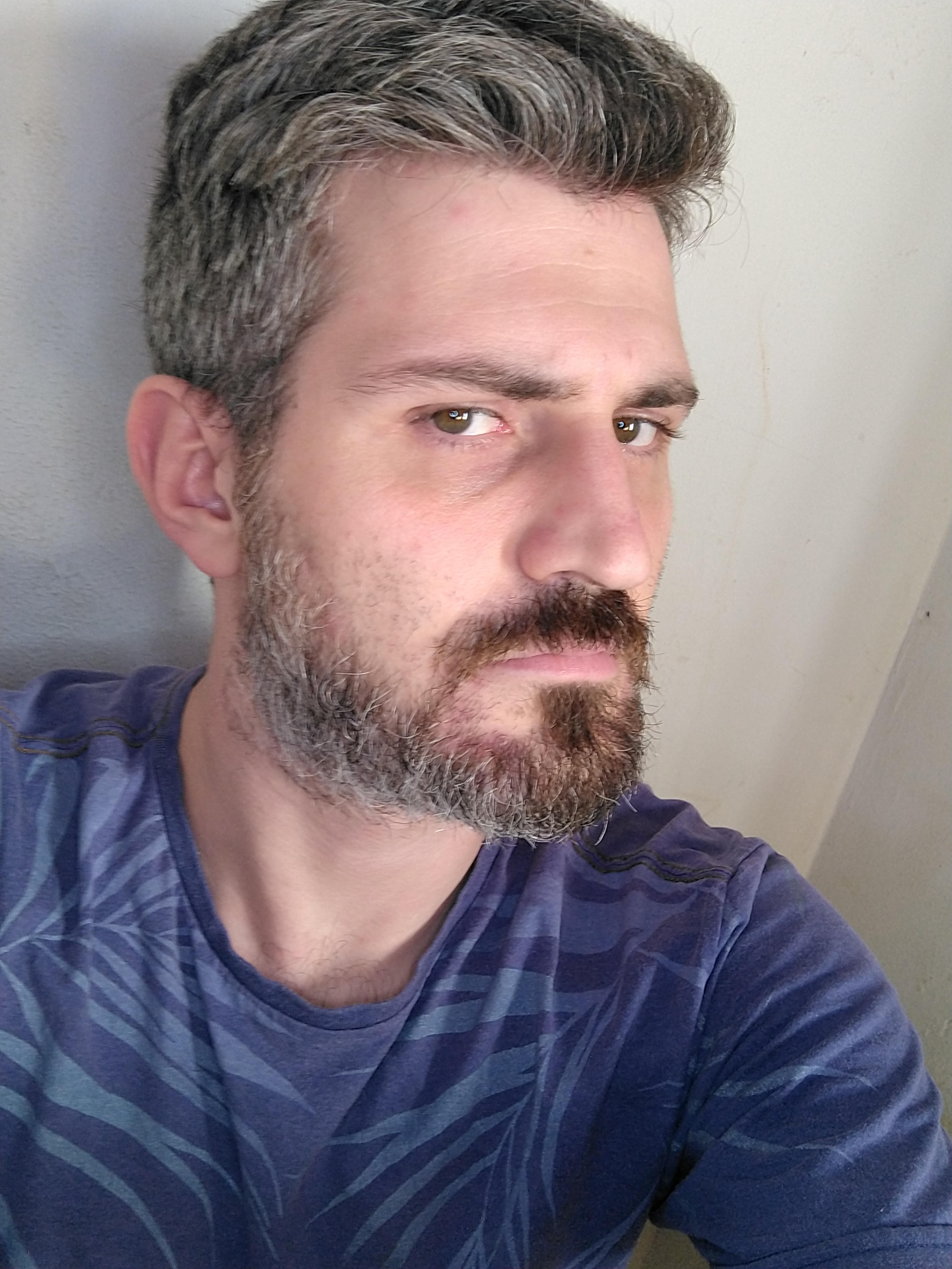 My hair is going gray at 32 Should I dye it? r/malegrooming