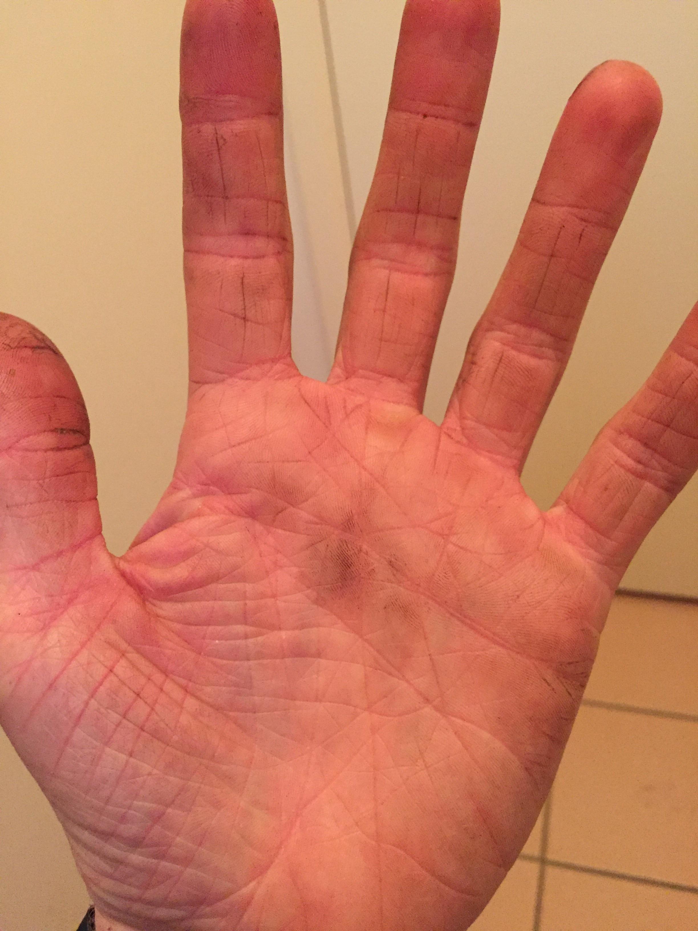 I have wrinkly hands (21M). r/mildlyinteresting