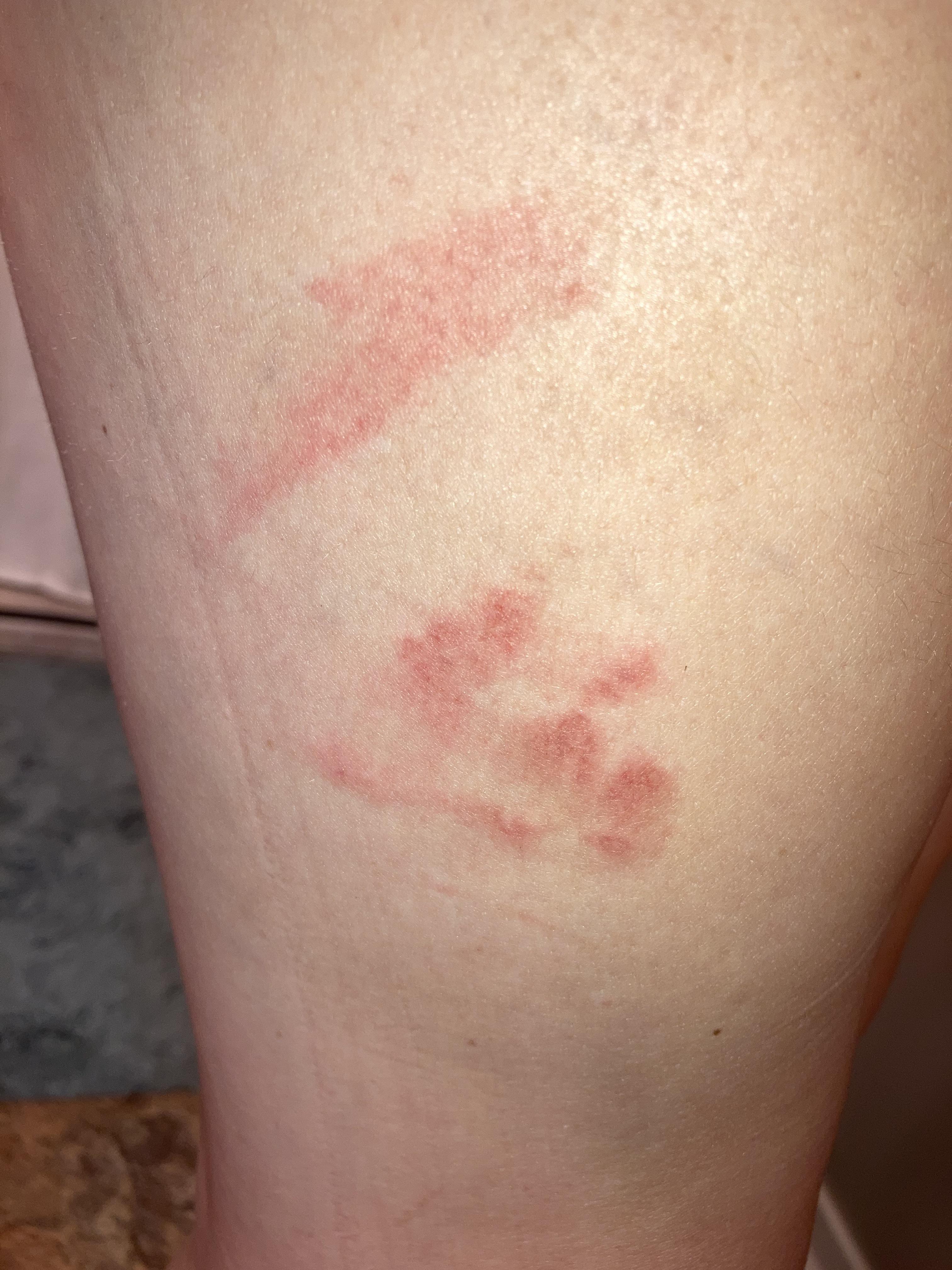 This popped up yesterday after my dog jumped on me(not really hard