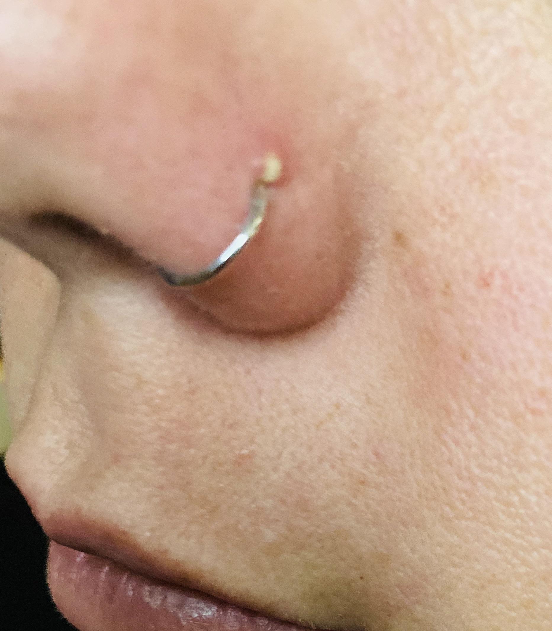 White looking filled bump appeared this morning. Is this infection or