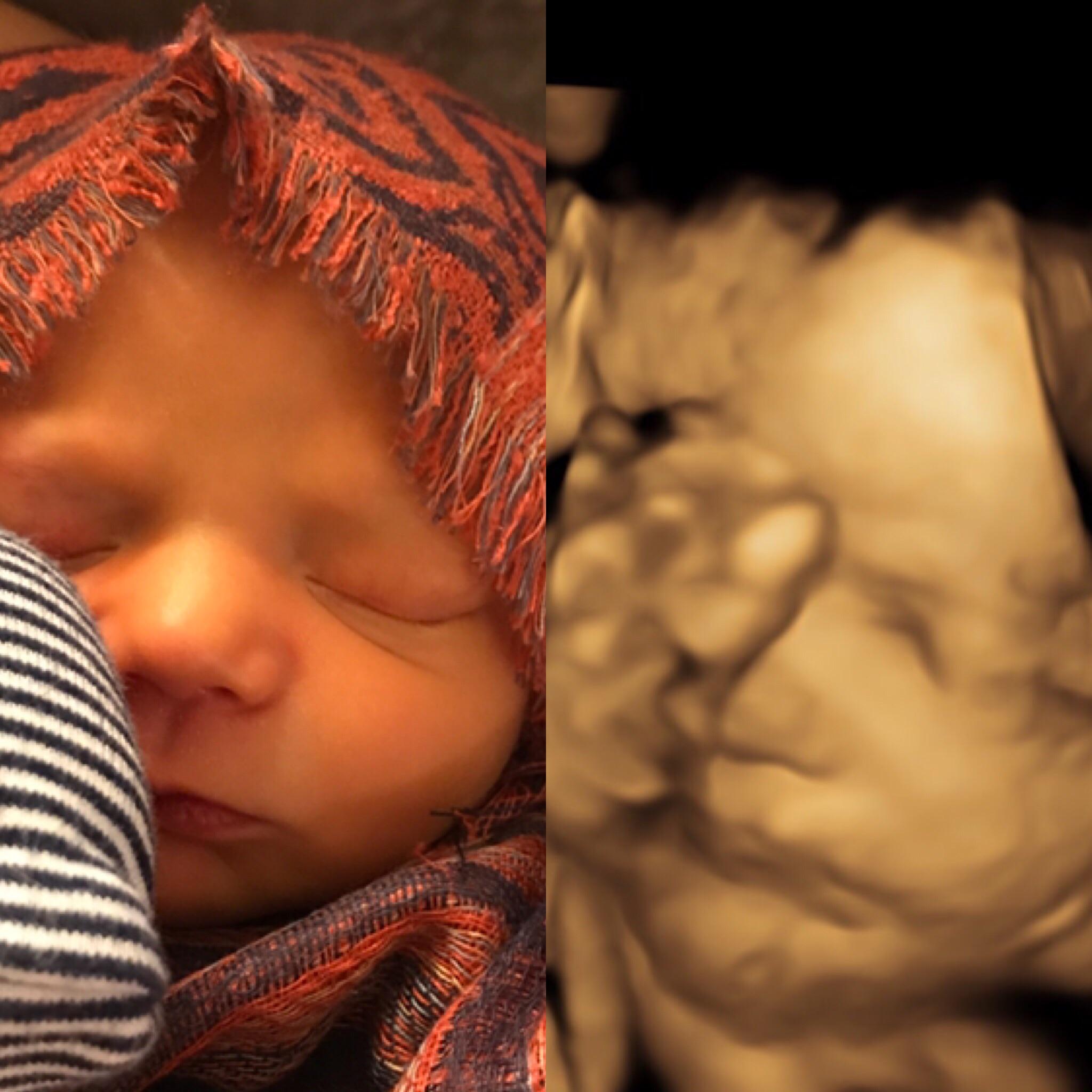 My 14 month old a few days after birth and my 32 week ultrasound of my