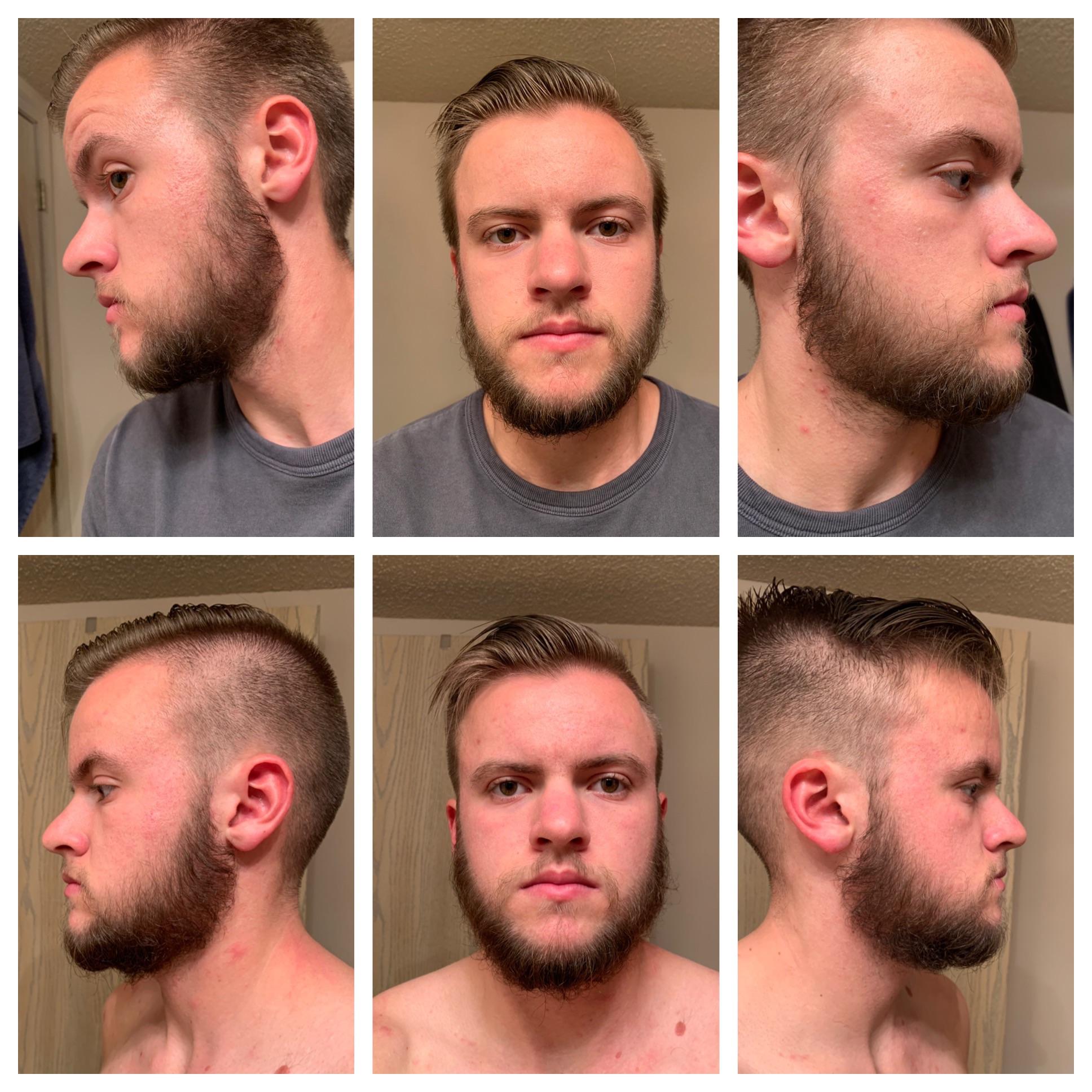 Results of no shave November. 21yo r/beards