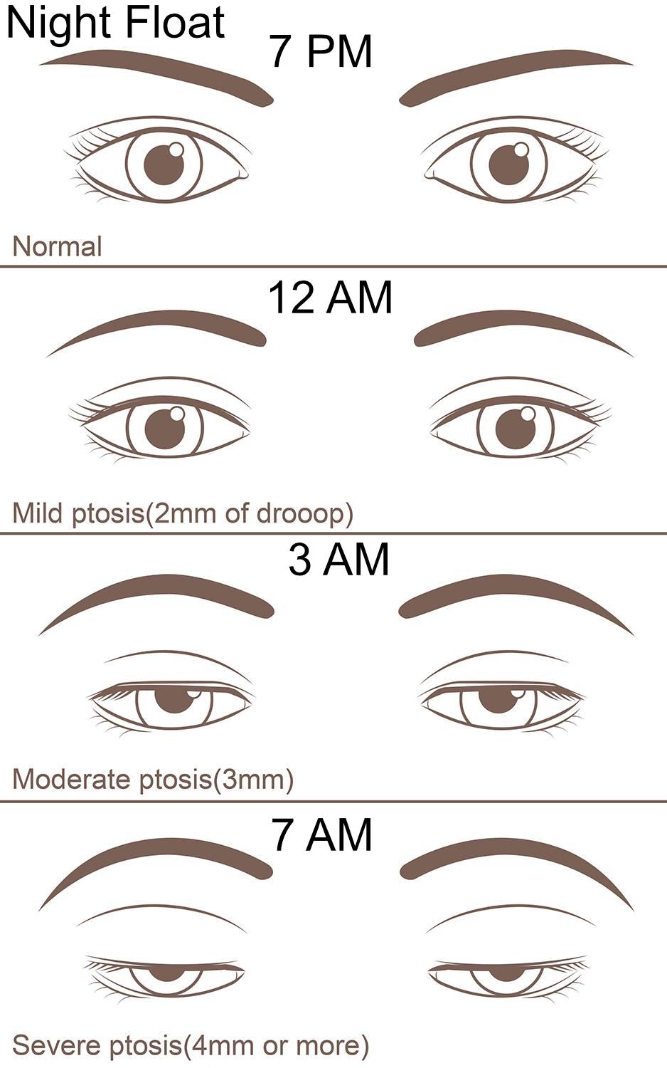 Night Float r/Residency