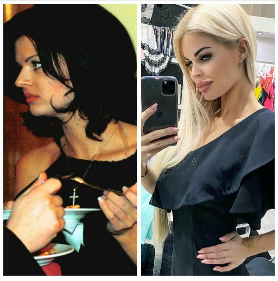 "Getting a nose job is normal." If only she'd stopped there