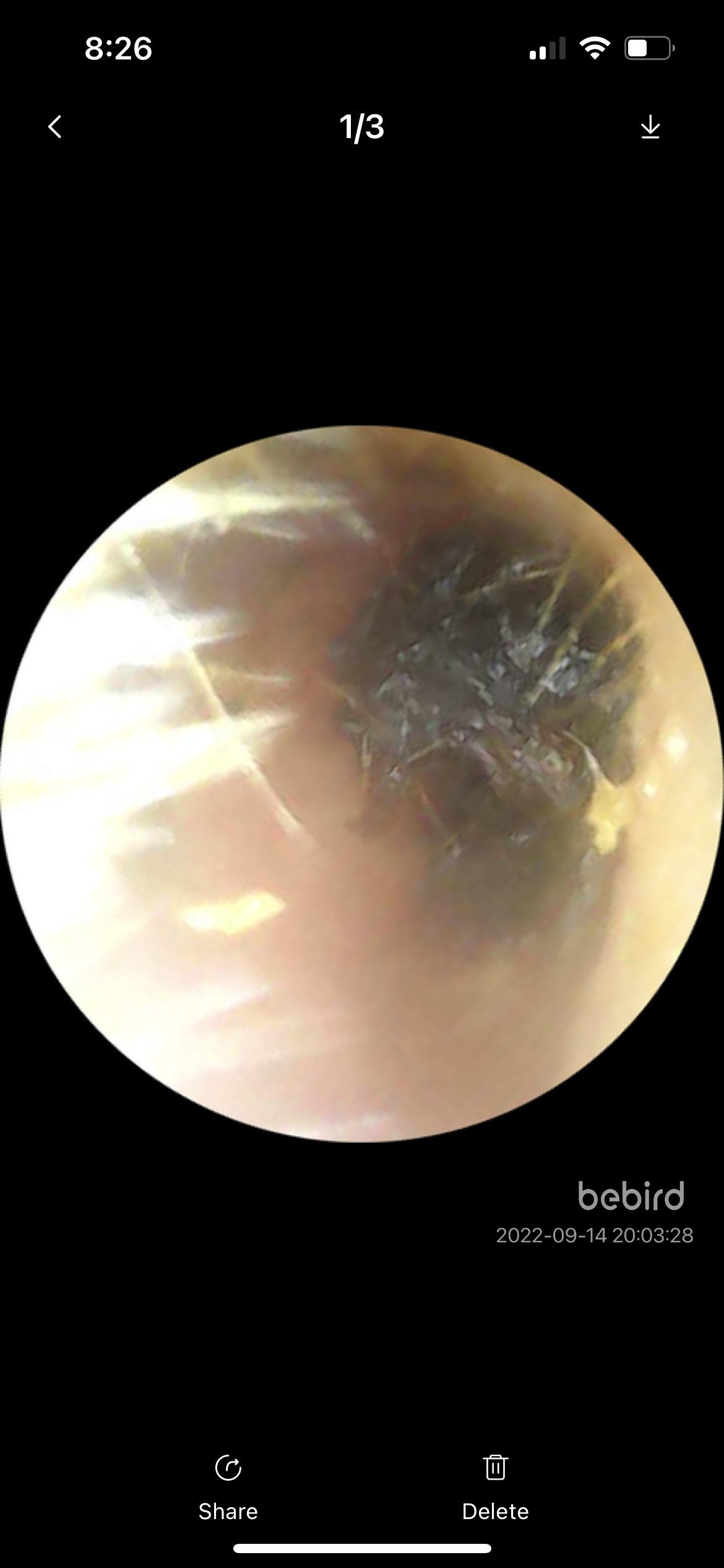 This is in my bf ear…. : r/earwax