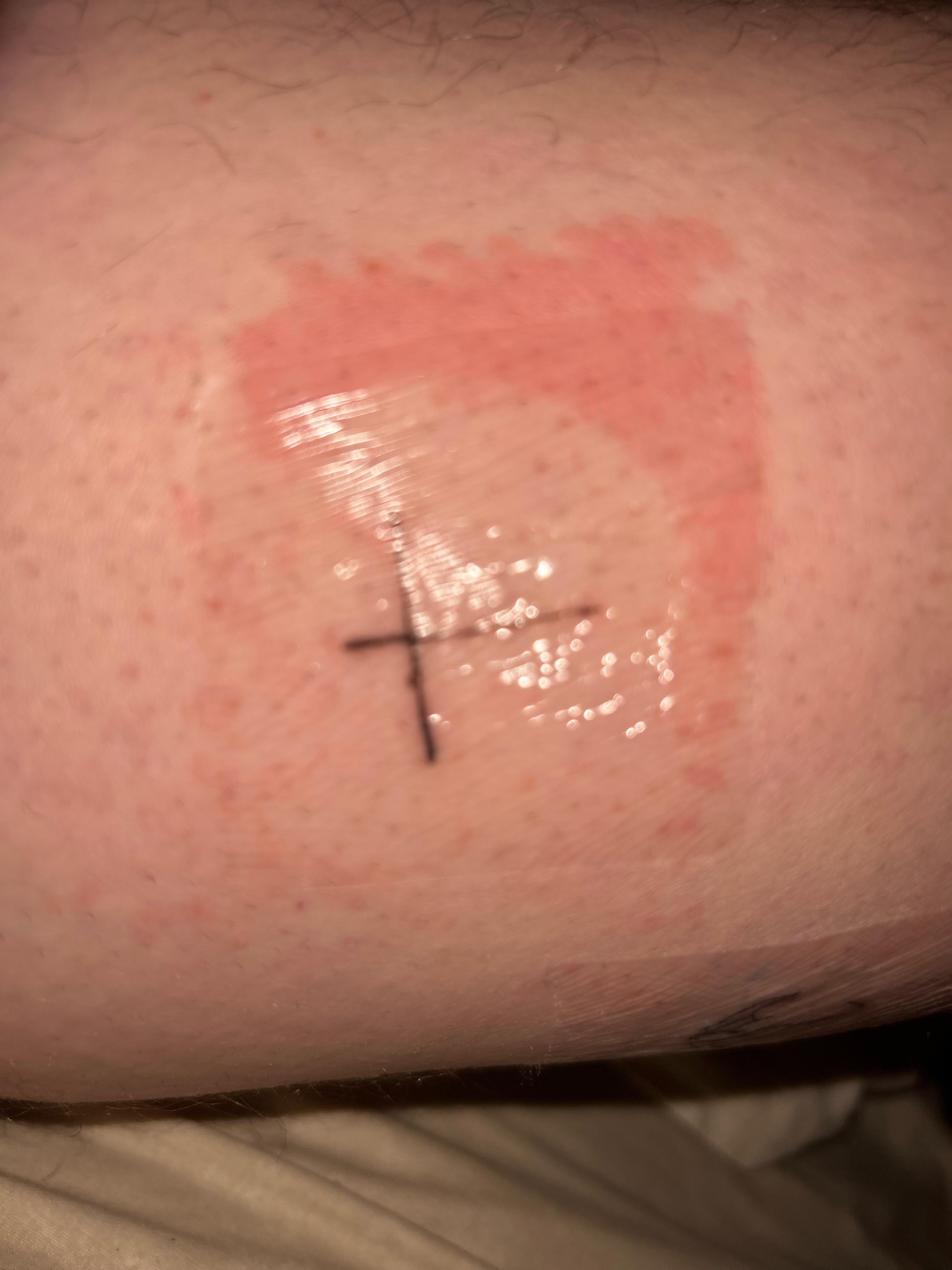 Dose the redness mean my tattoo is getting infected r/medical_advice