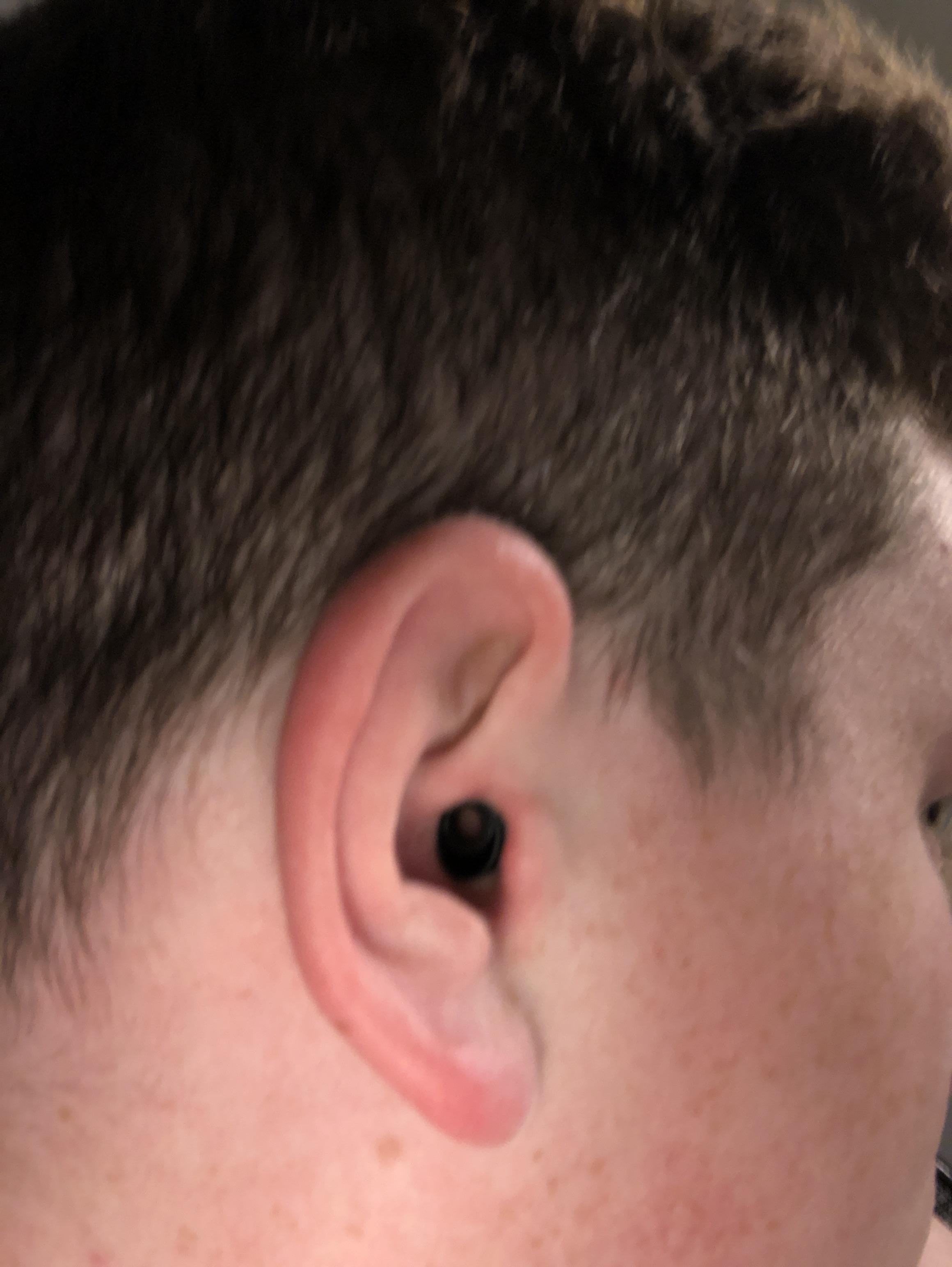 I got the earbud thing stuck in my ear r/mildlyinfuriating