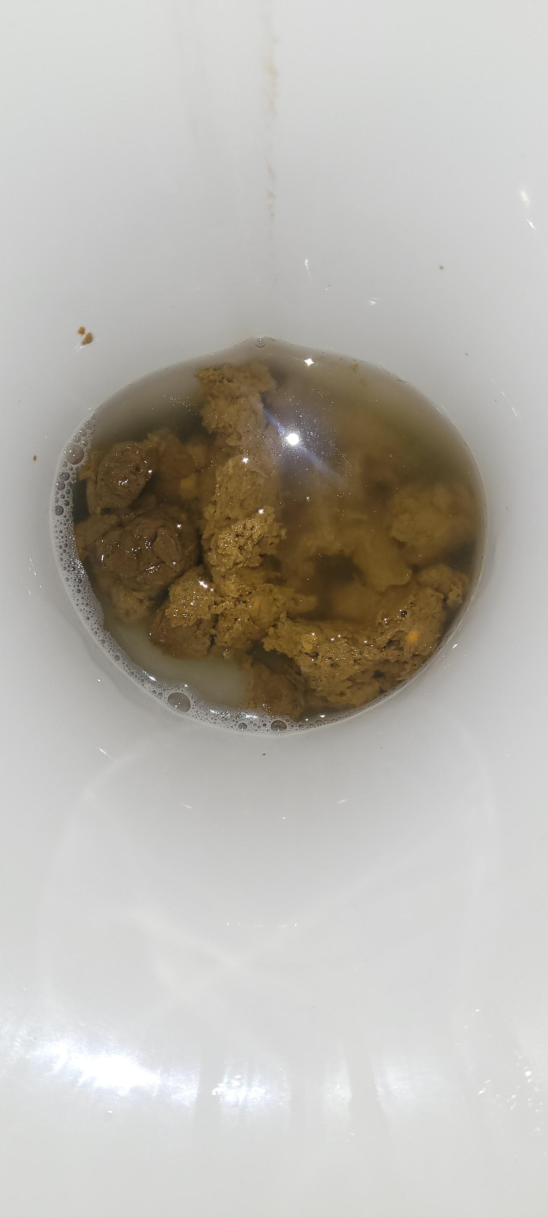 IBS ? r/poop