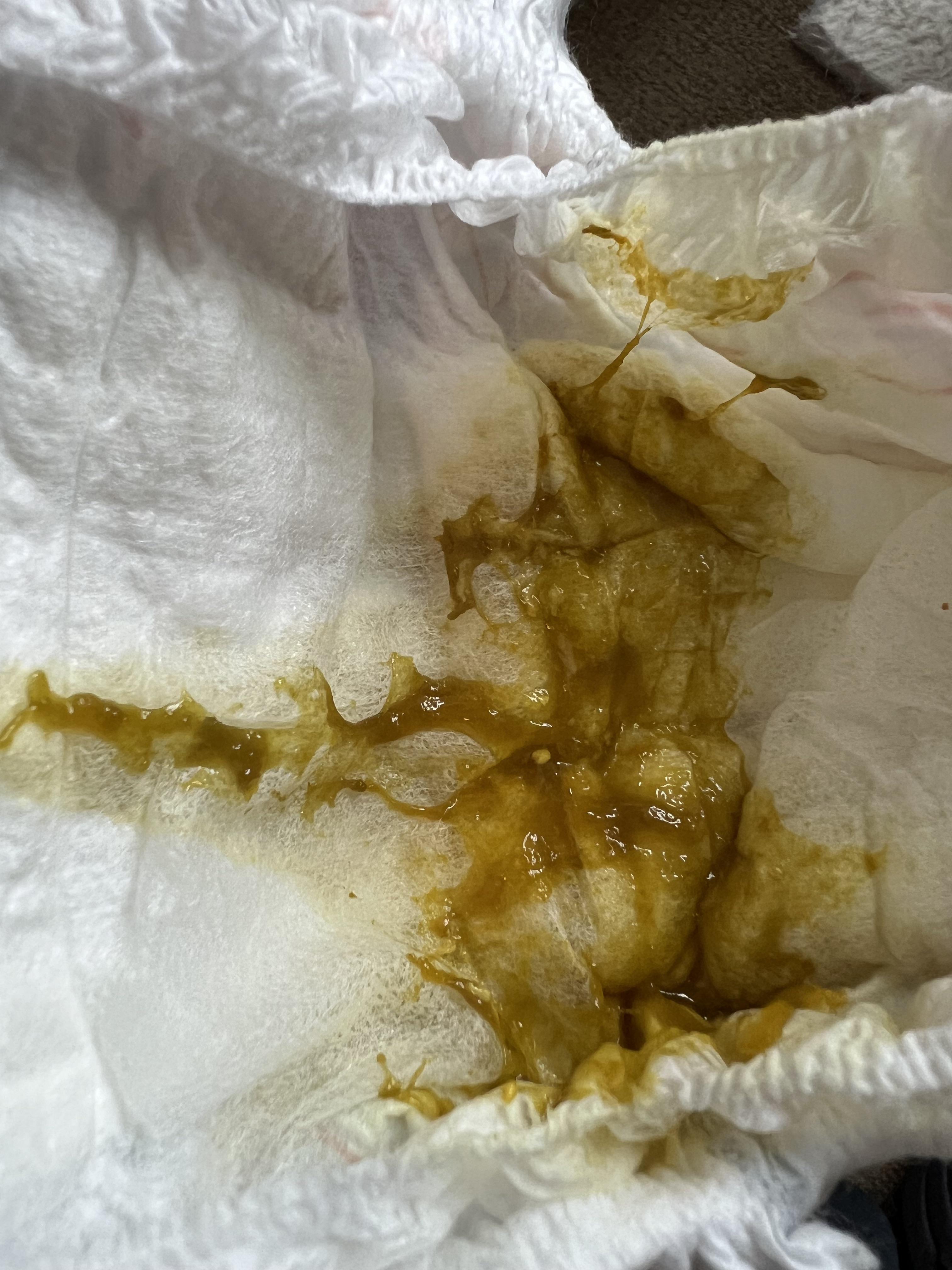 Green and slimy poop? r/newborns