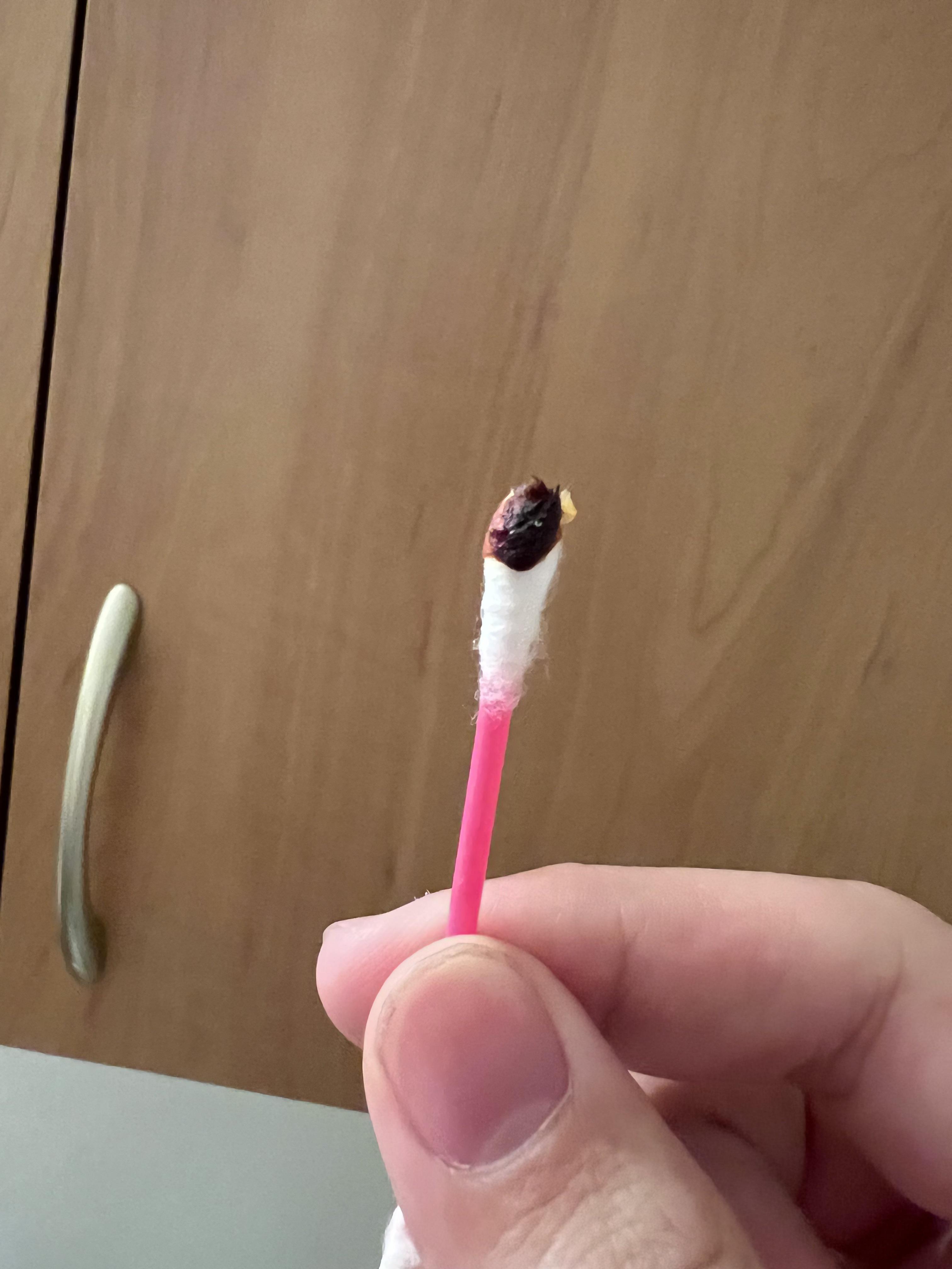 Is this normal? Like the red color? r/earwax