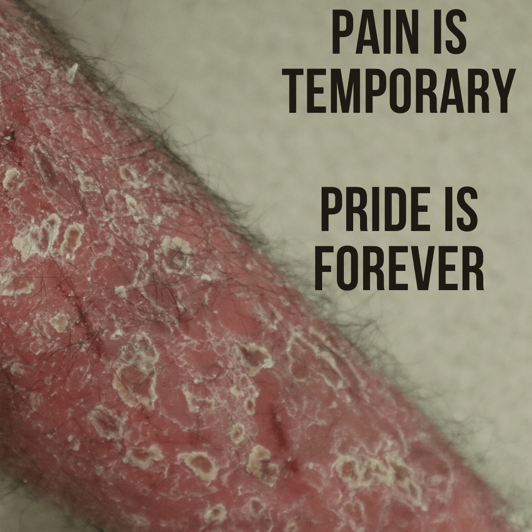 Tough Times lead to a lot of pain, but we have to push through! The