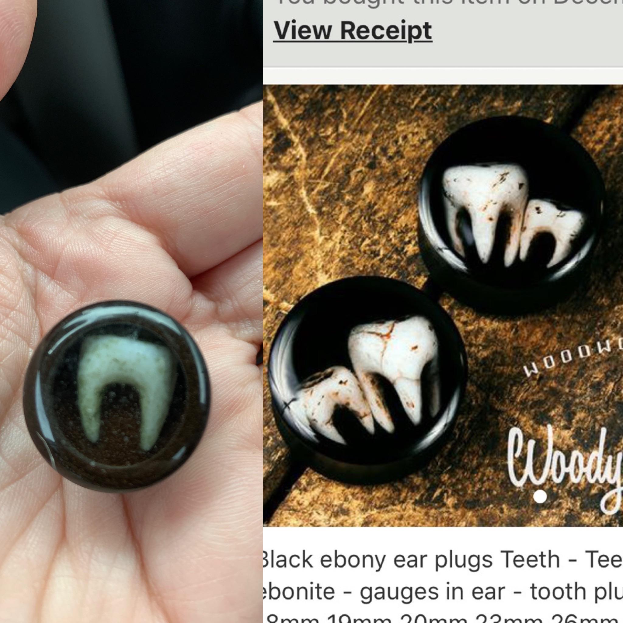 The wife’s new teeth (tooth?) ear plugs r/ExpectationVsReality