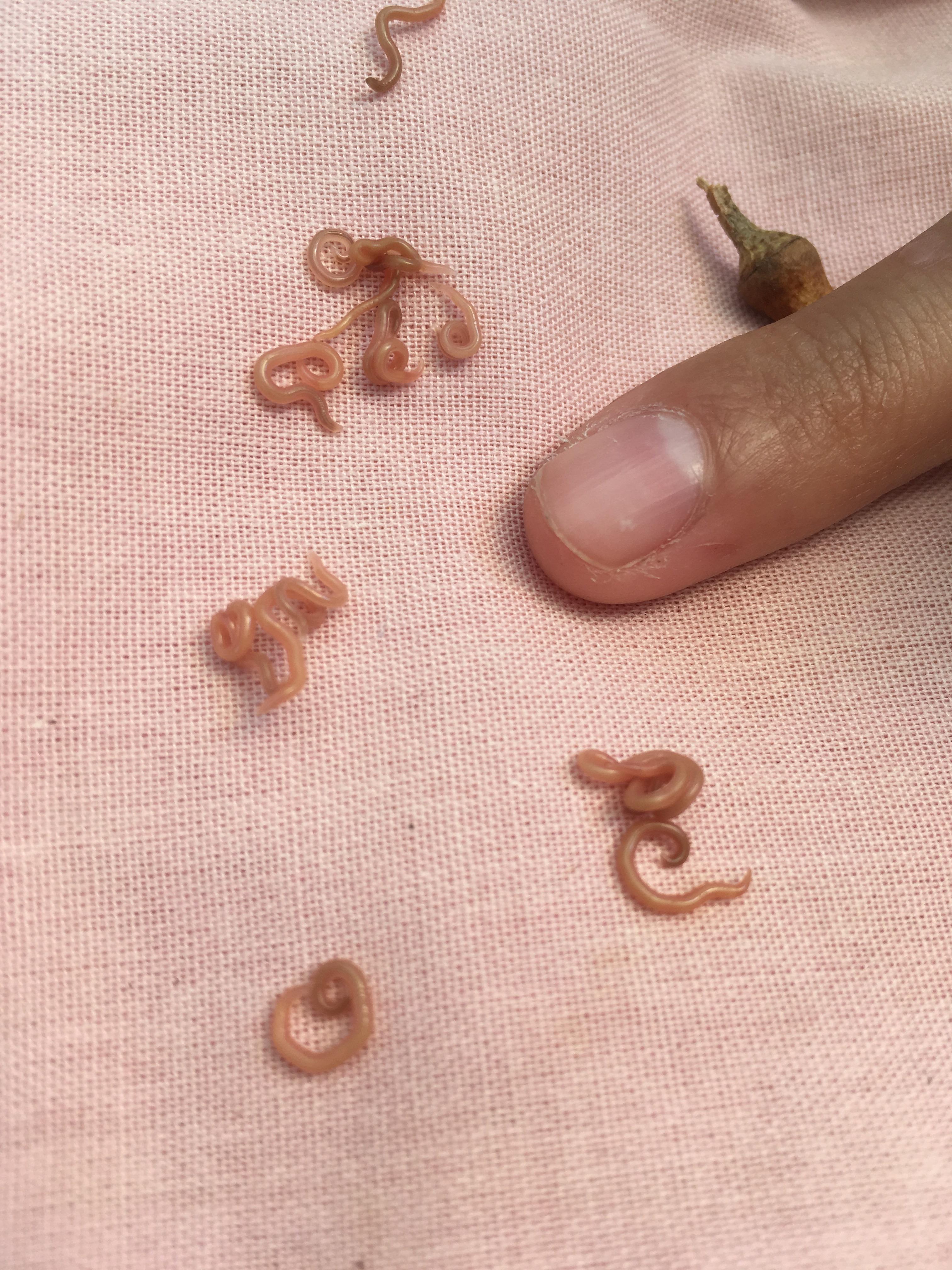 Mysterious worms found in the mouth of an oriental bearded man