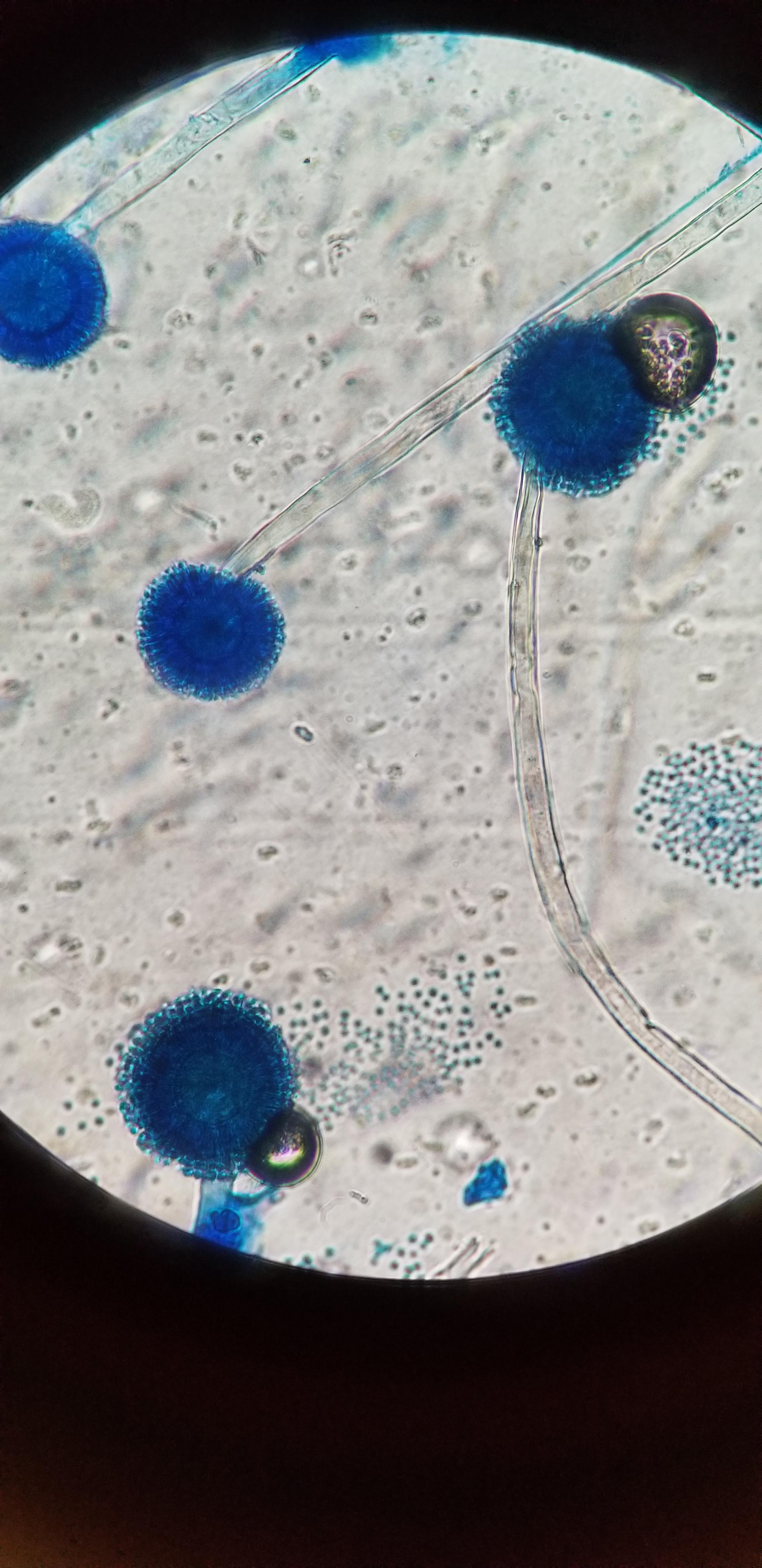 Ear culture! r/mycology