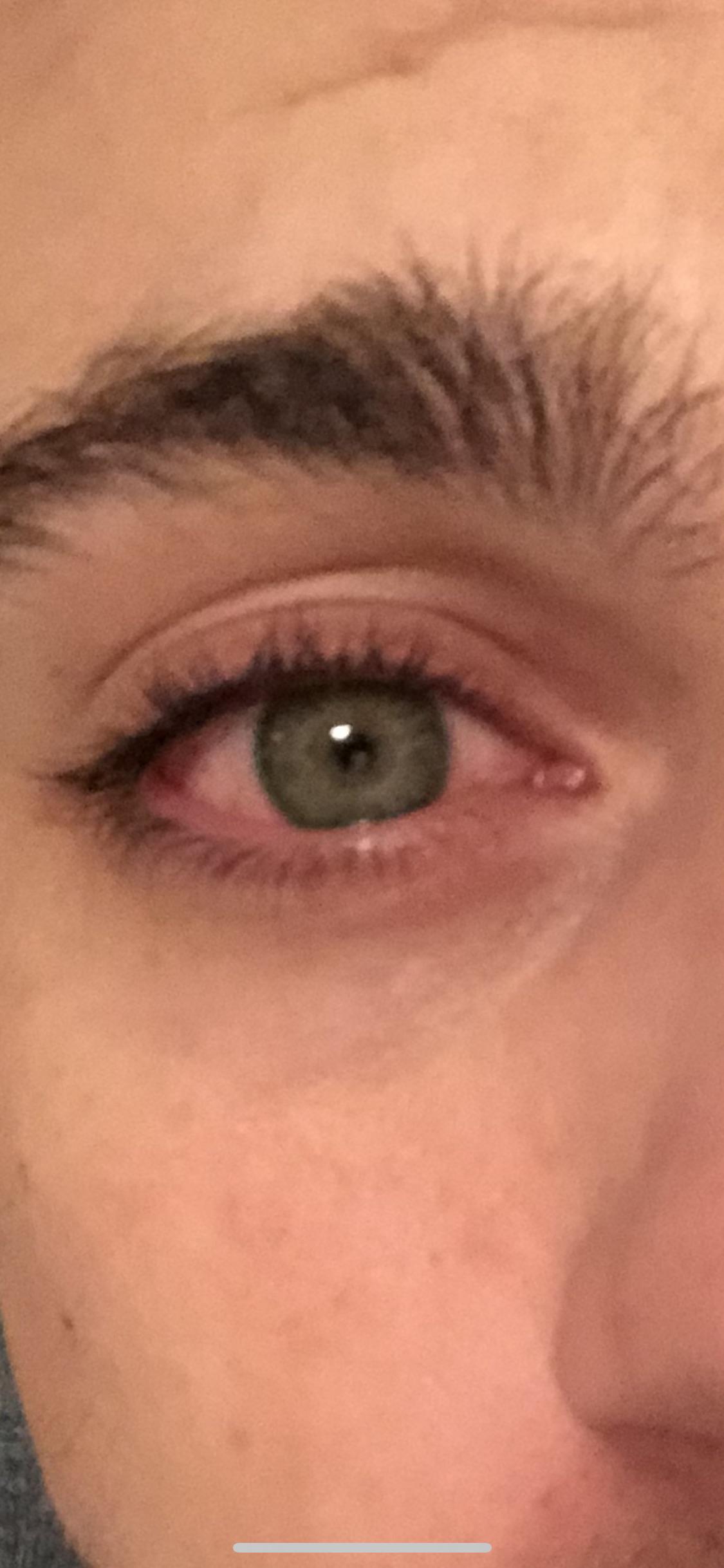 Stupid stoned eyes weed