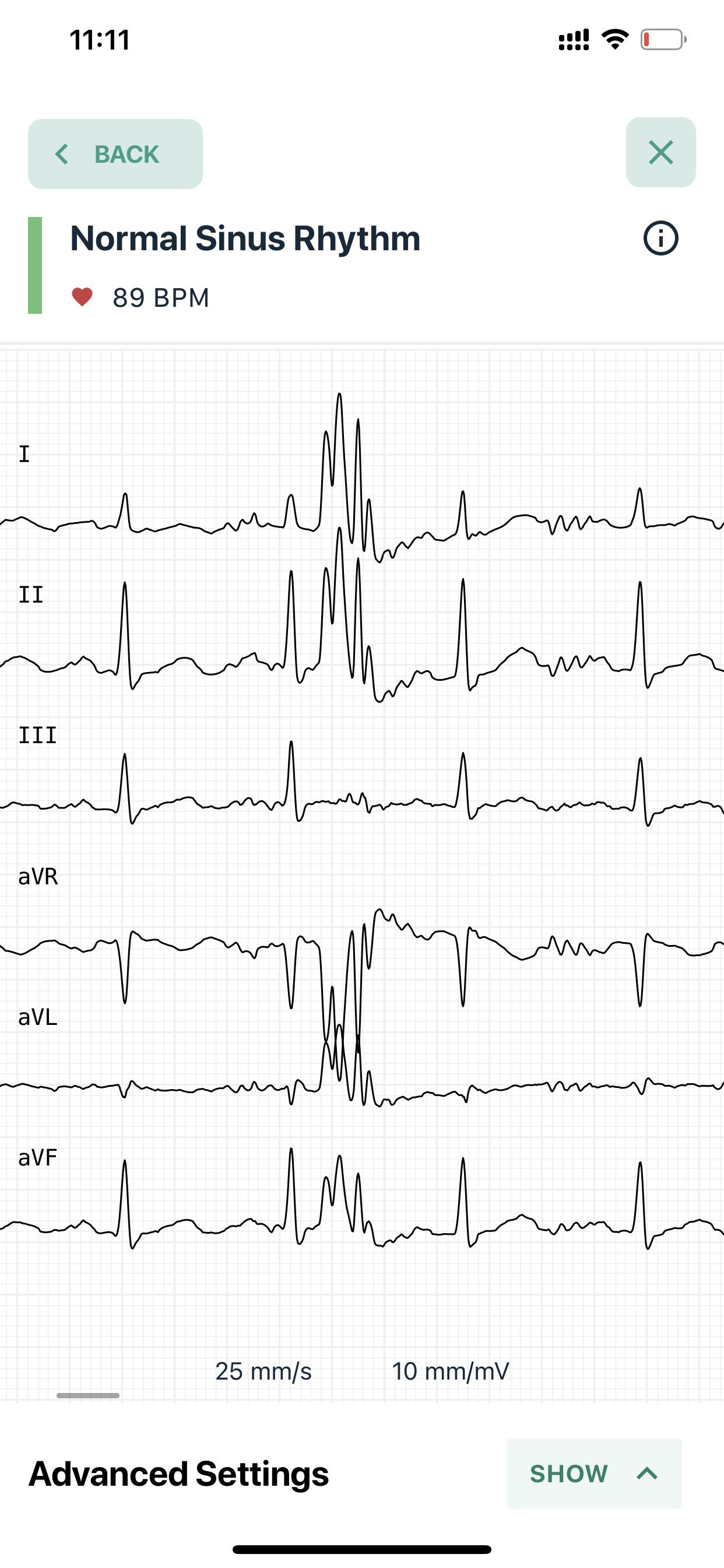 Help! Was having chest pains last night, everytime my chest pain would