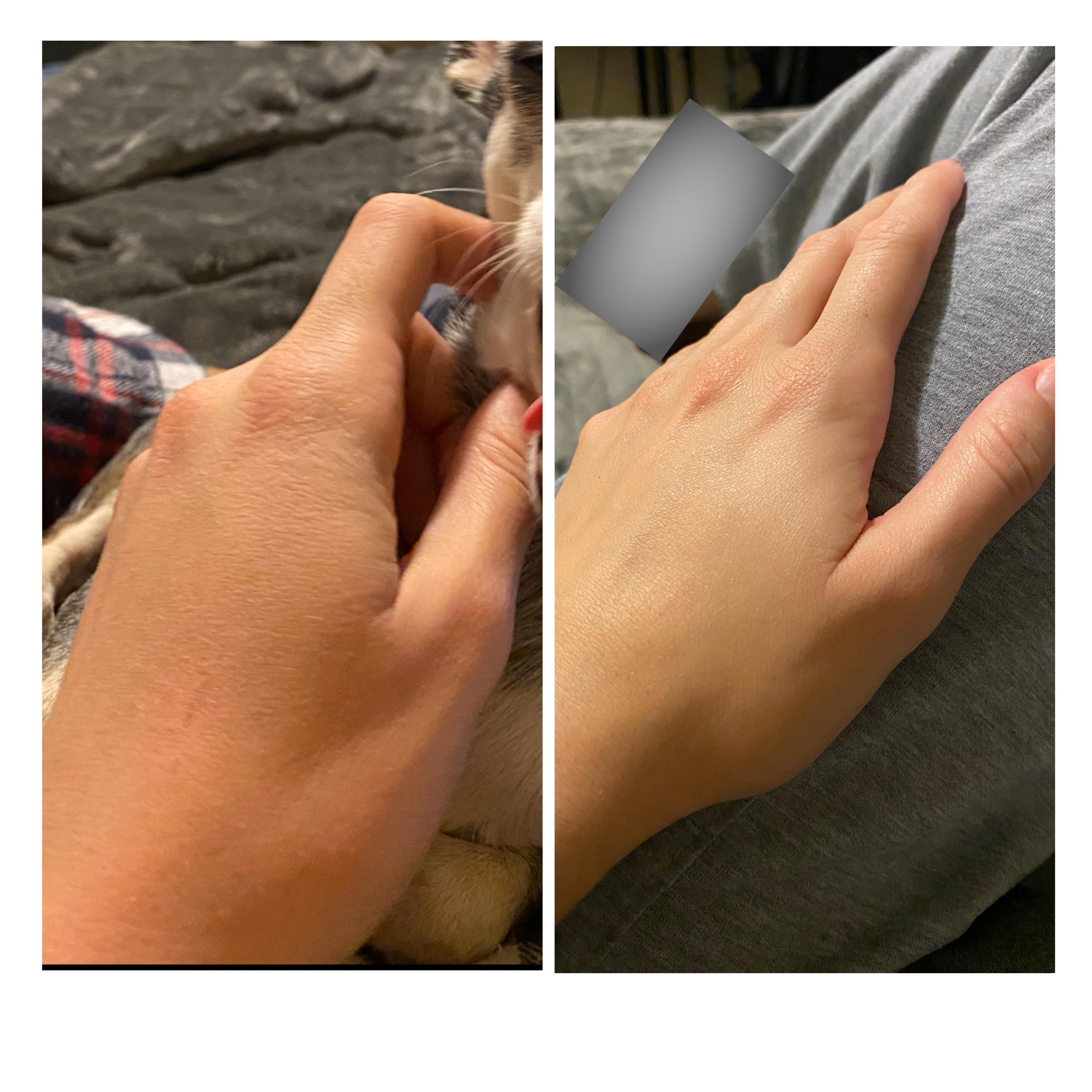 Vaseline Advanced Repair Healing Lotion Photos are only 3 days apart