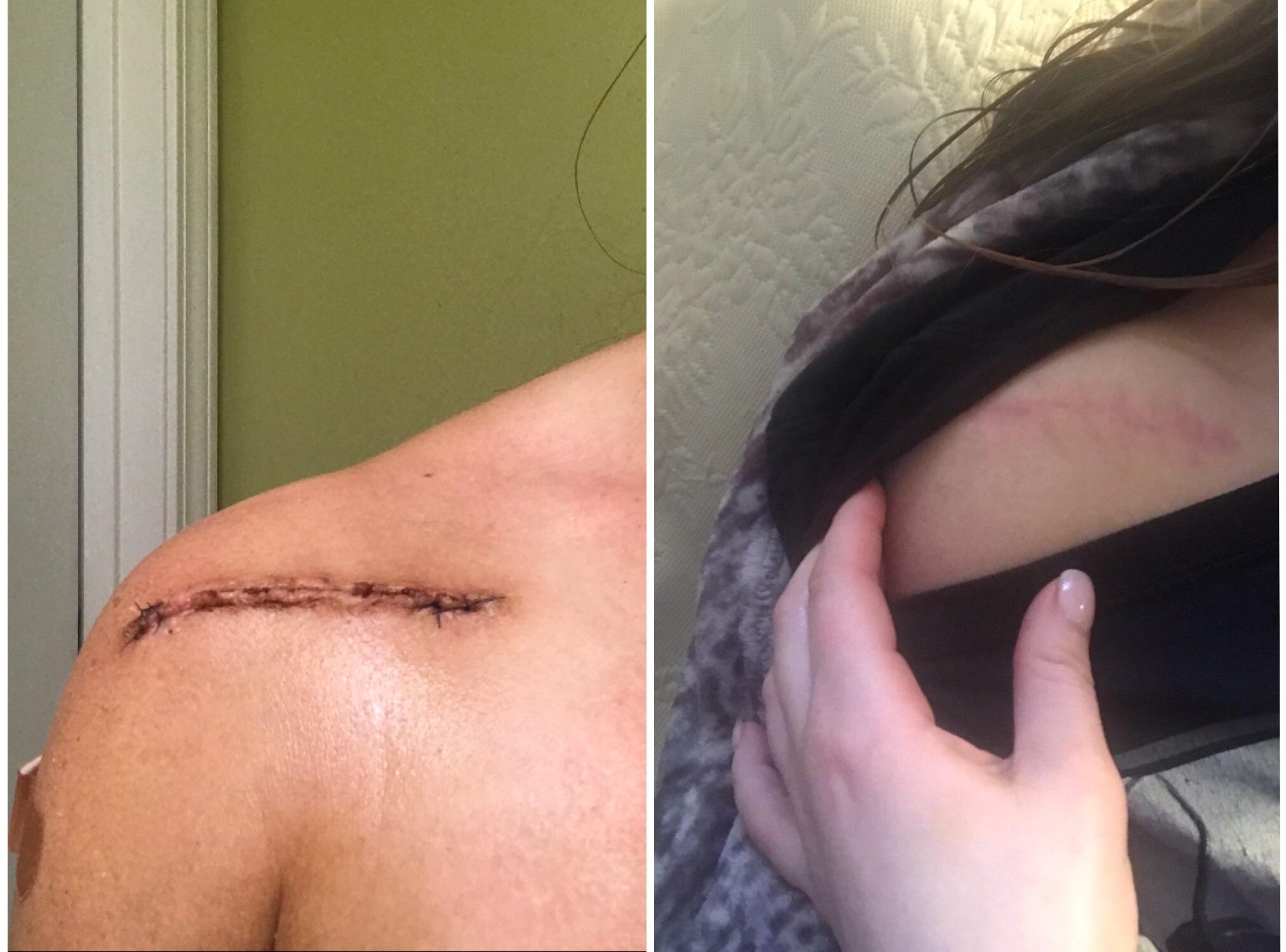 What OCD looks like for me. I got a tattoo Nov. 2017 & then decided I