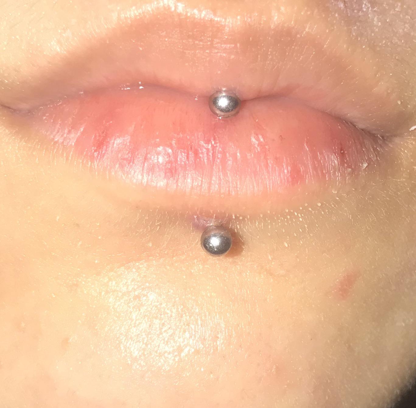 lip vertical labret piercing bump not going away piercing