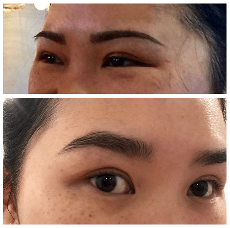 My brow transformation over 9 months. From overplucked & harshly filledin to completely natural