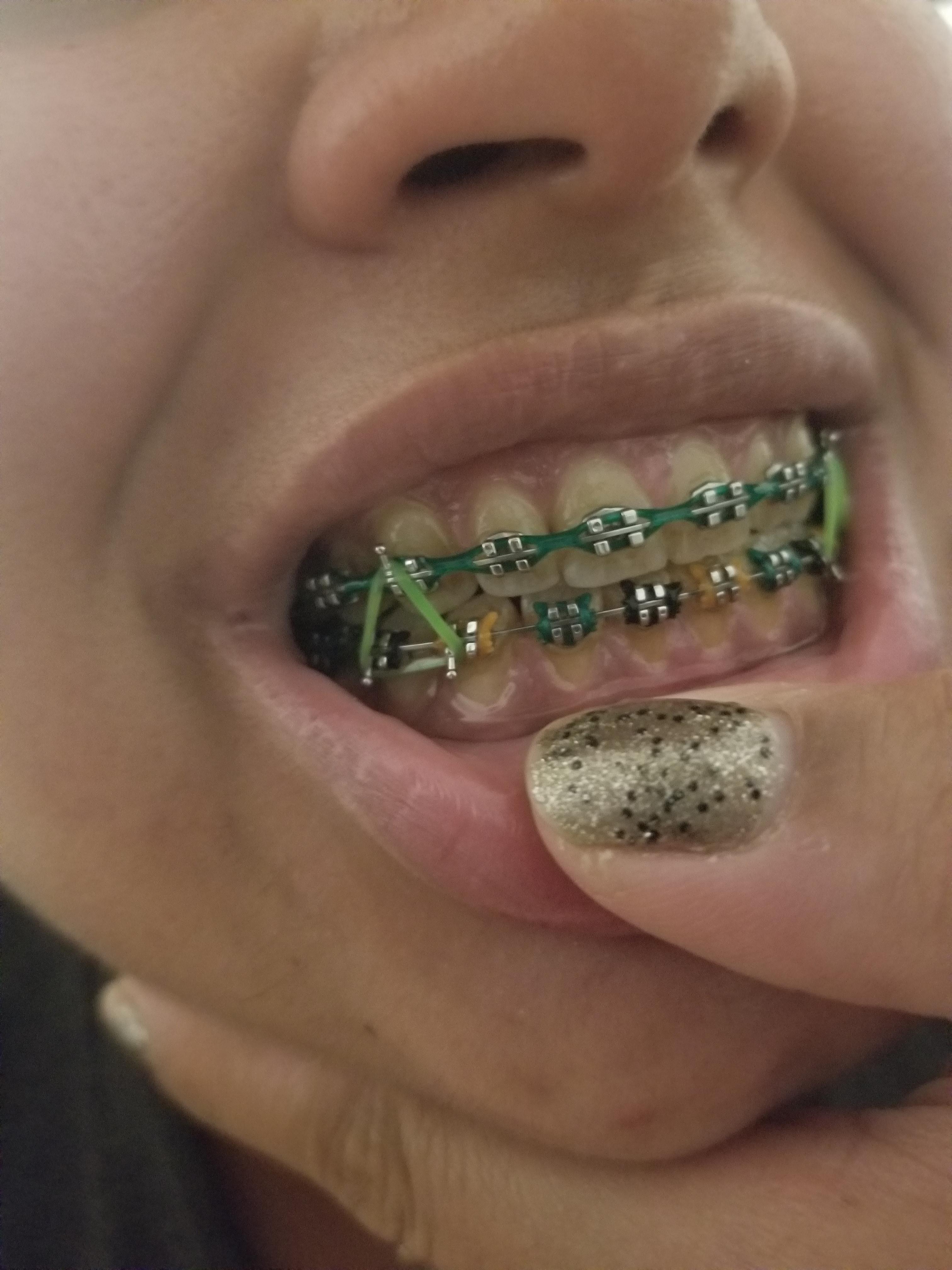 Getting used to these elastics! Anyone else have Halloween colors at