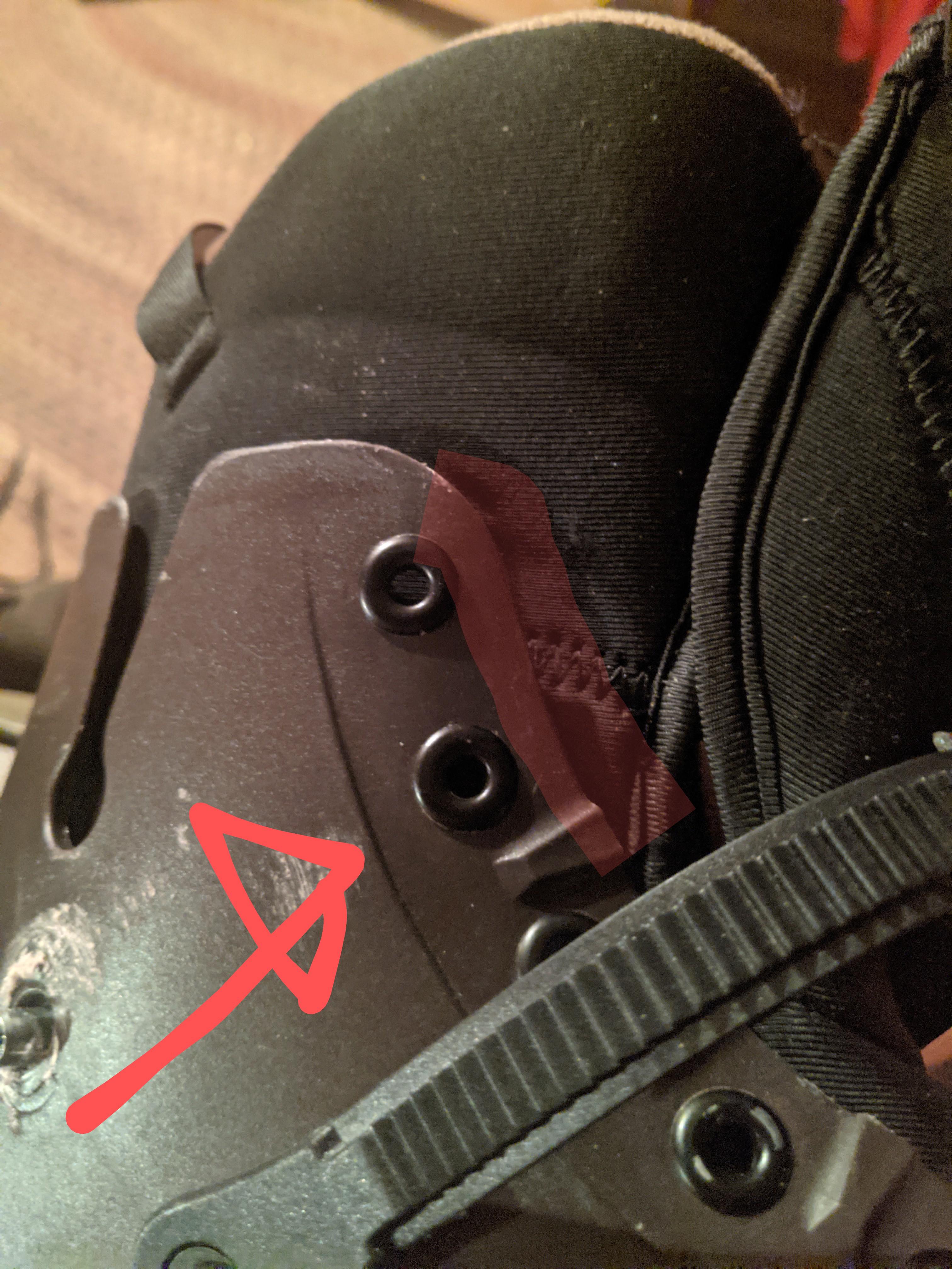 Ankle pain from inside ridge, what should I do? r/rollerblading