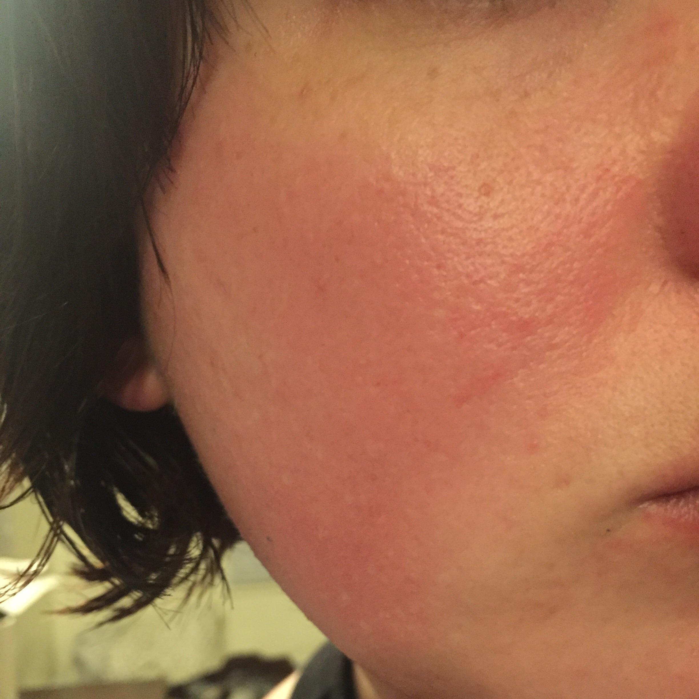 Does Makeup Ruin Your Skin Reddit Makeupview.co