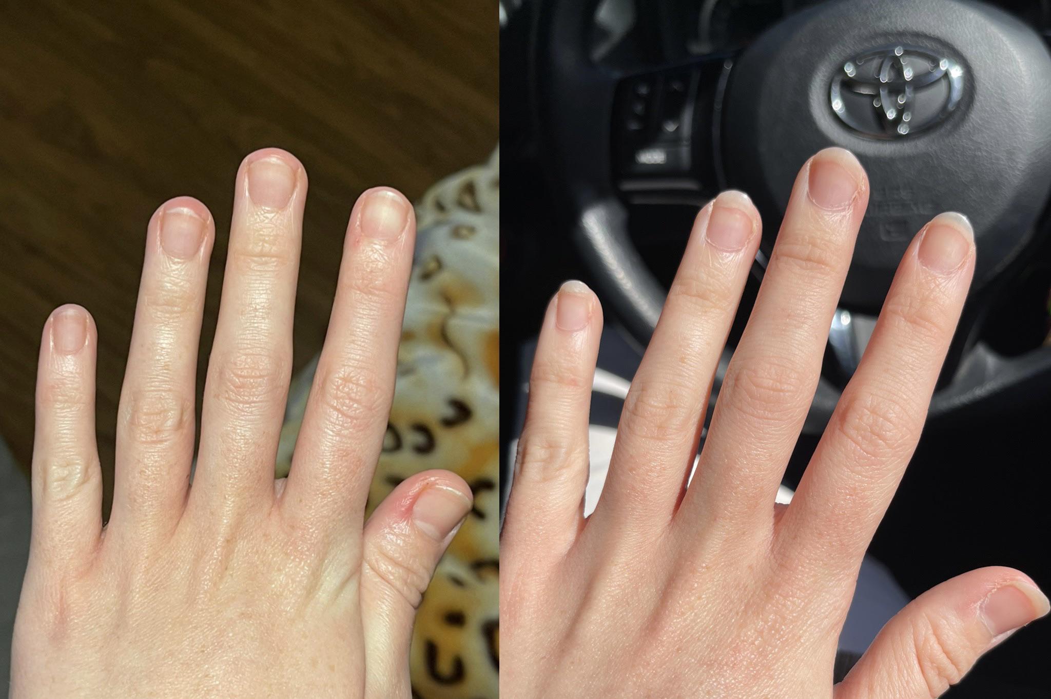 1 month of nail growth. Would you consider this amount of growth in 1