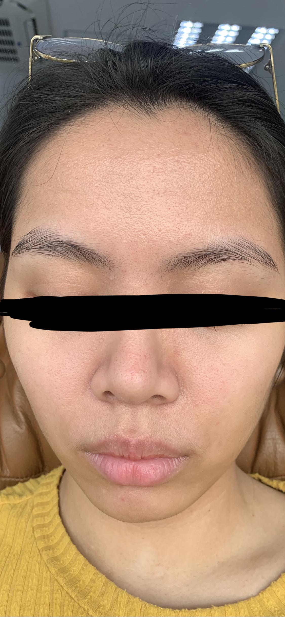 skin texture & large pores. any help? SkincareAddicts
