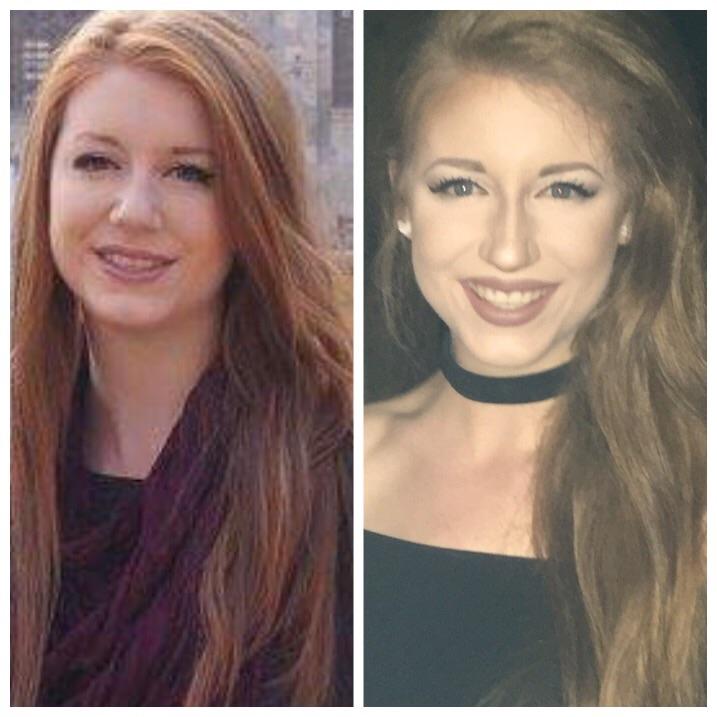 F/23/5’9” [160 > 148 = 12 lbs] (8 weeks) Face progress! I gained a lot