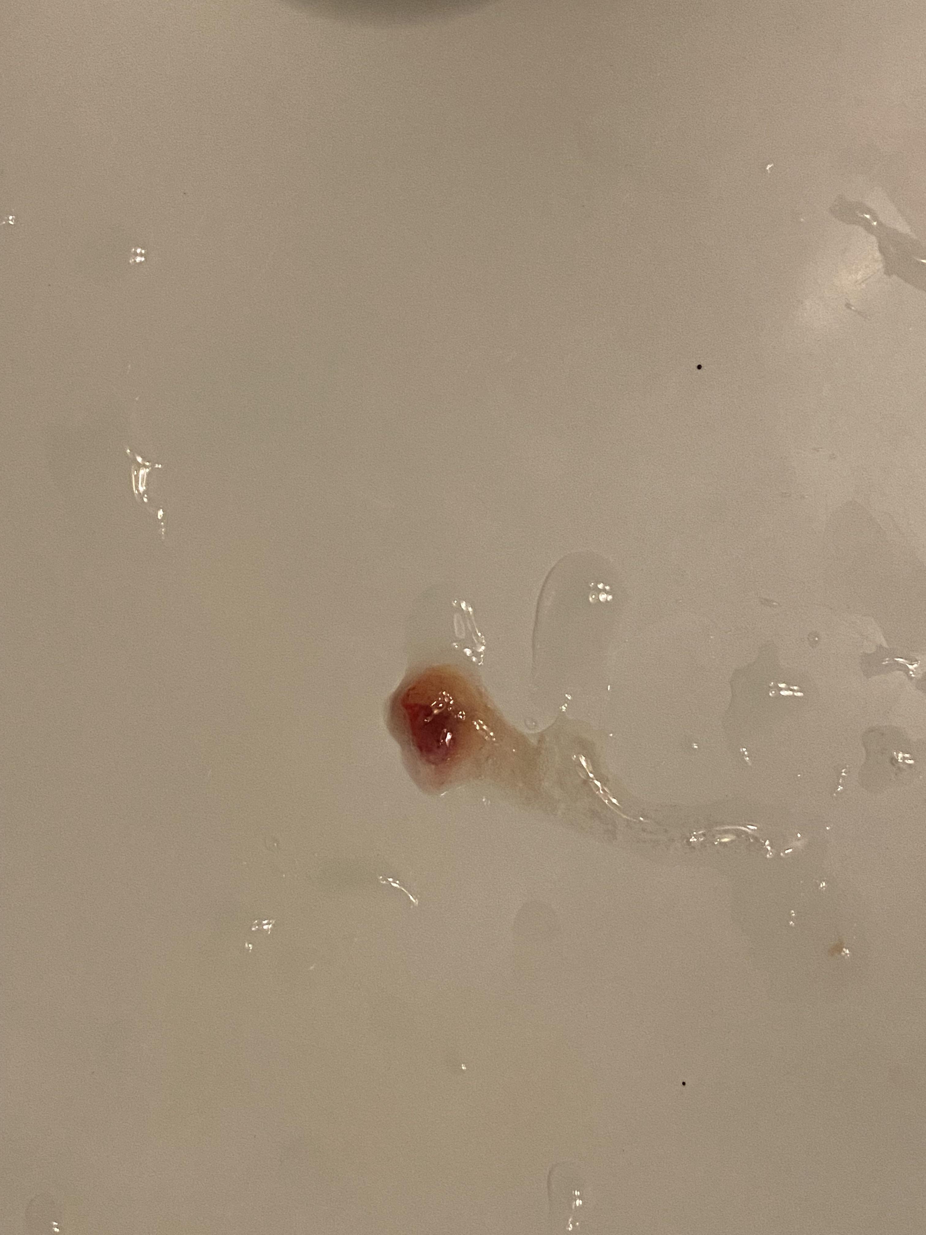 Covid+, on Day 3 of Paxlovid and Coughing Up Bright Red Blood. Low