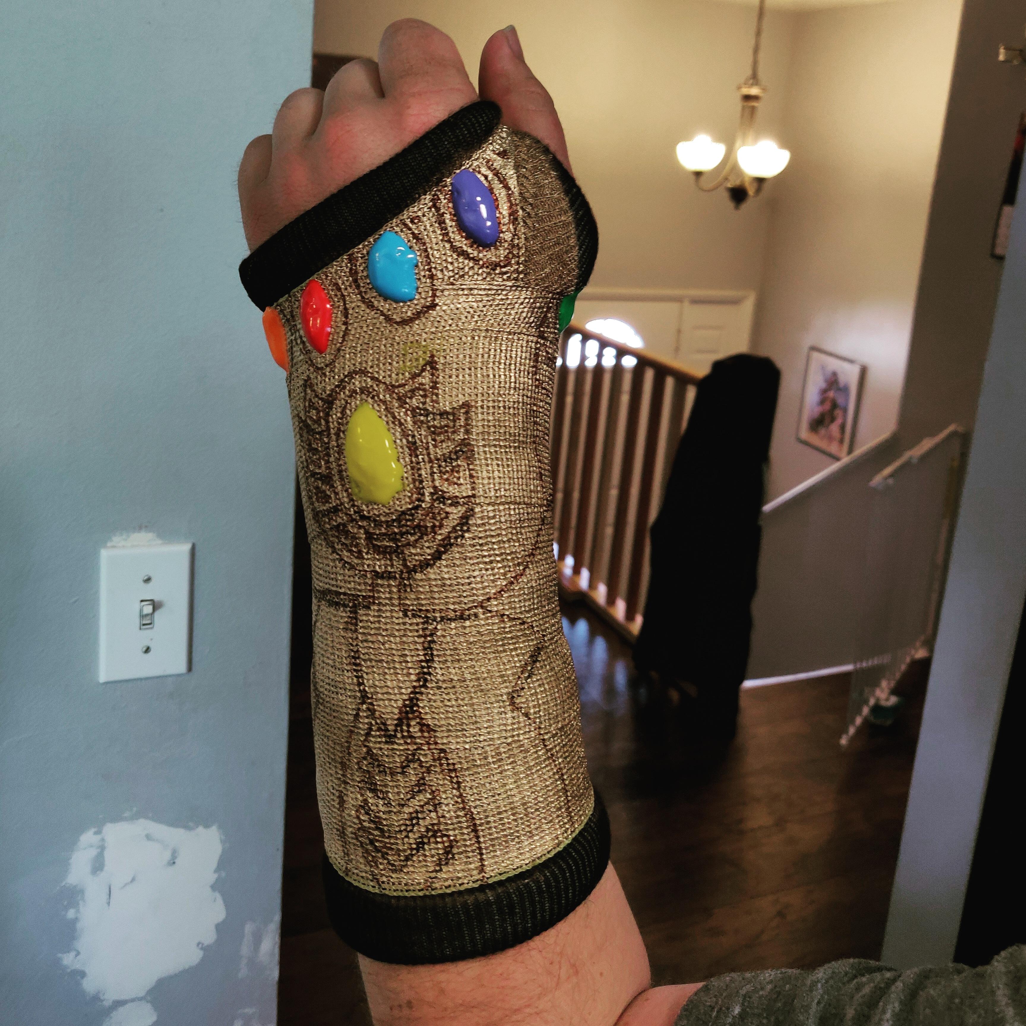 So I got my hard cast put on today and had some fun with it. r/pics