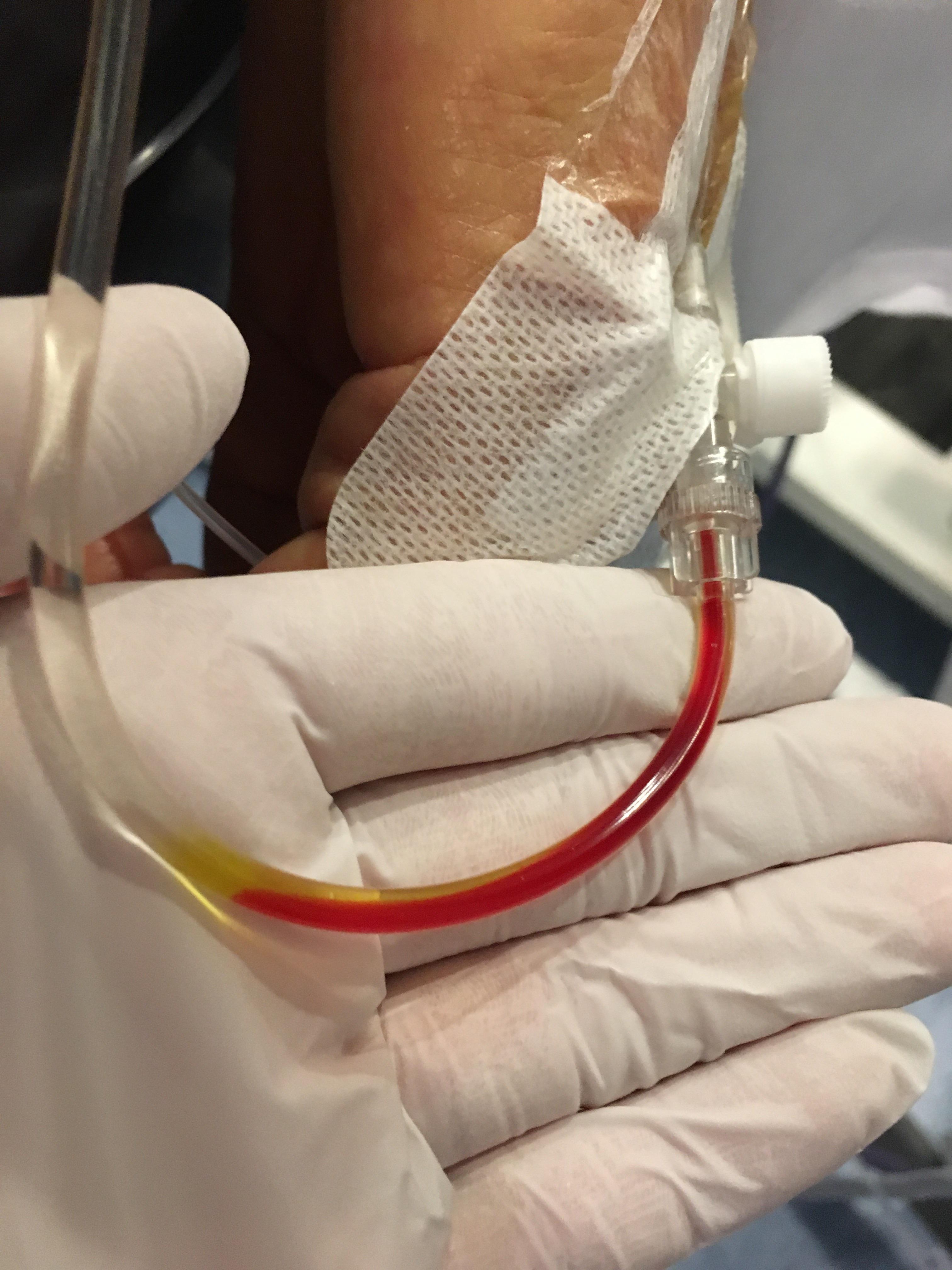 What do you mean “jaundice”? Isn’t blood _supposed_ to be yellow? r