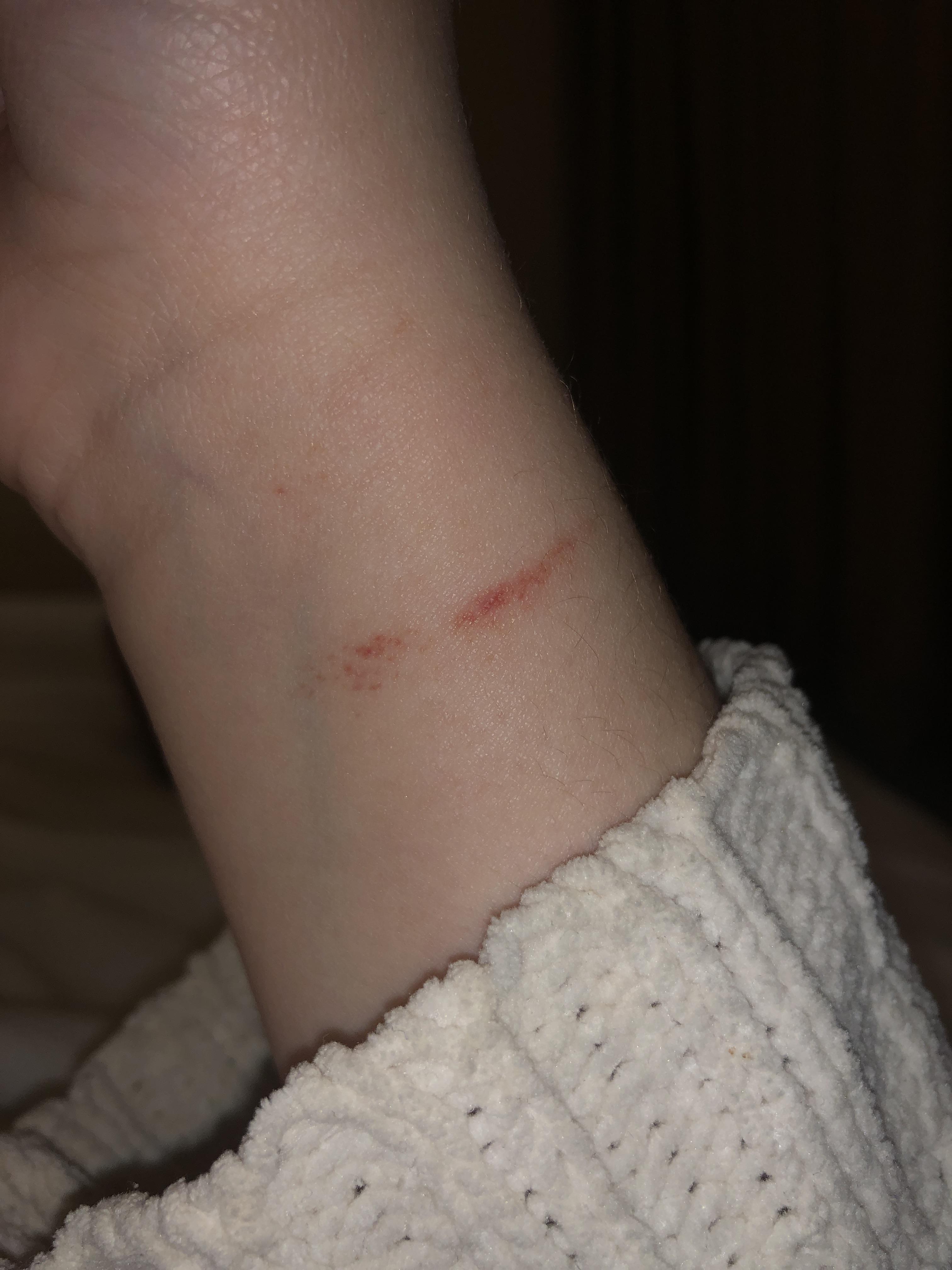 This showed up after I was carrying a heavy purse, with my laptop in it