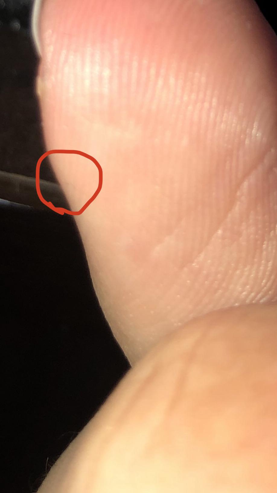 This incredibly small, incredibly painful, ungrabable splinter that I had to end up just cutting