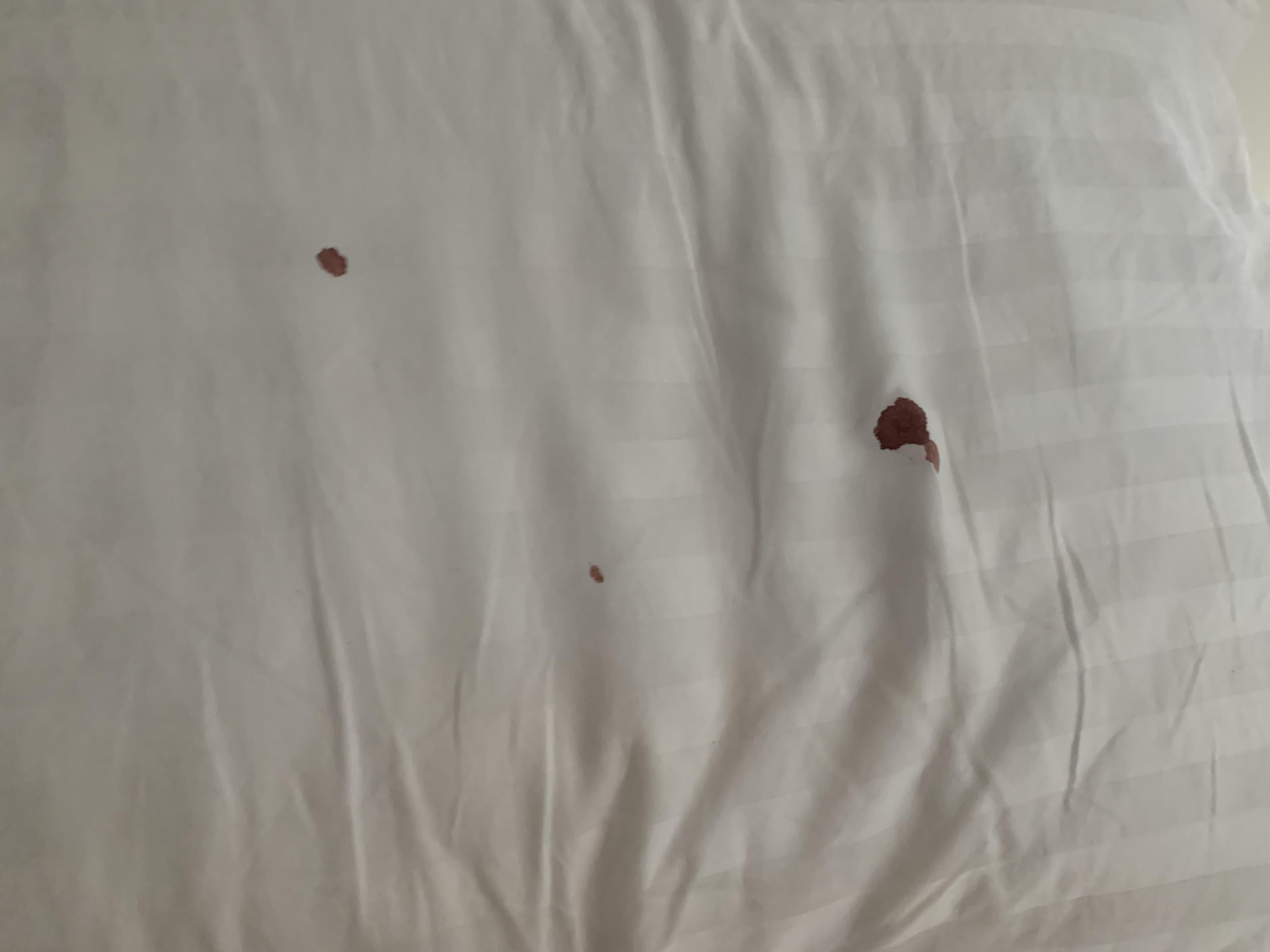 Not nearly as bad as some, but after checking my nose, I have