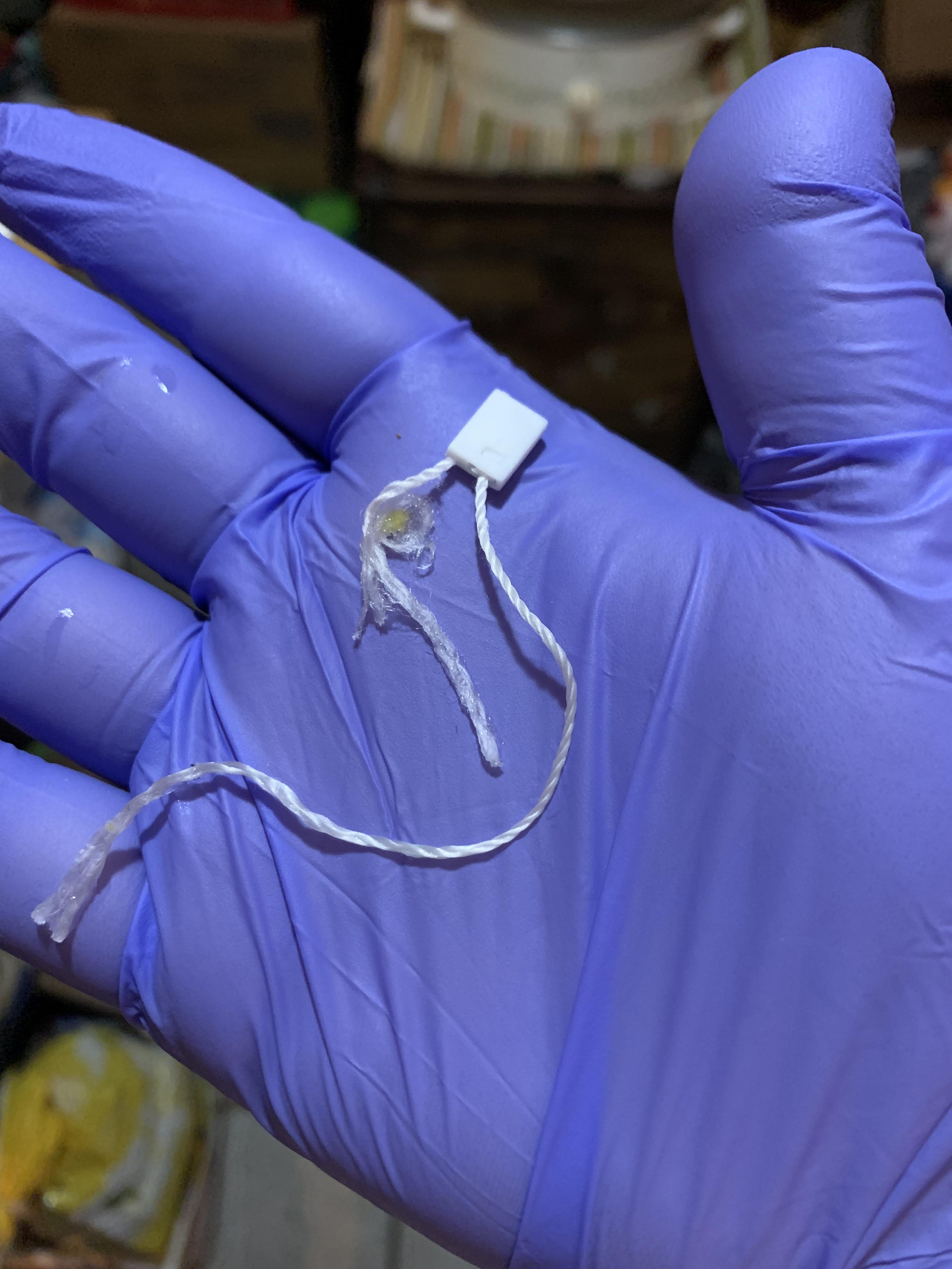 paragard falling out? r/CopperIUD