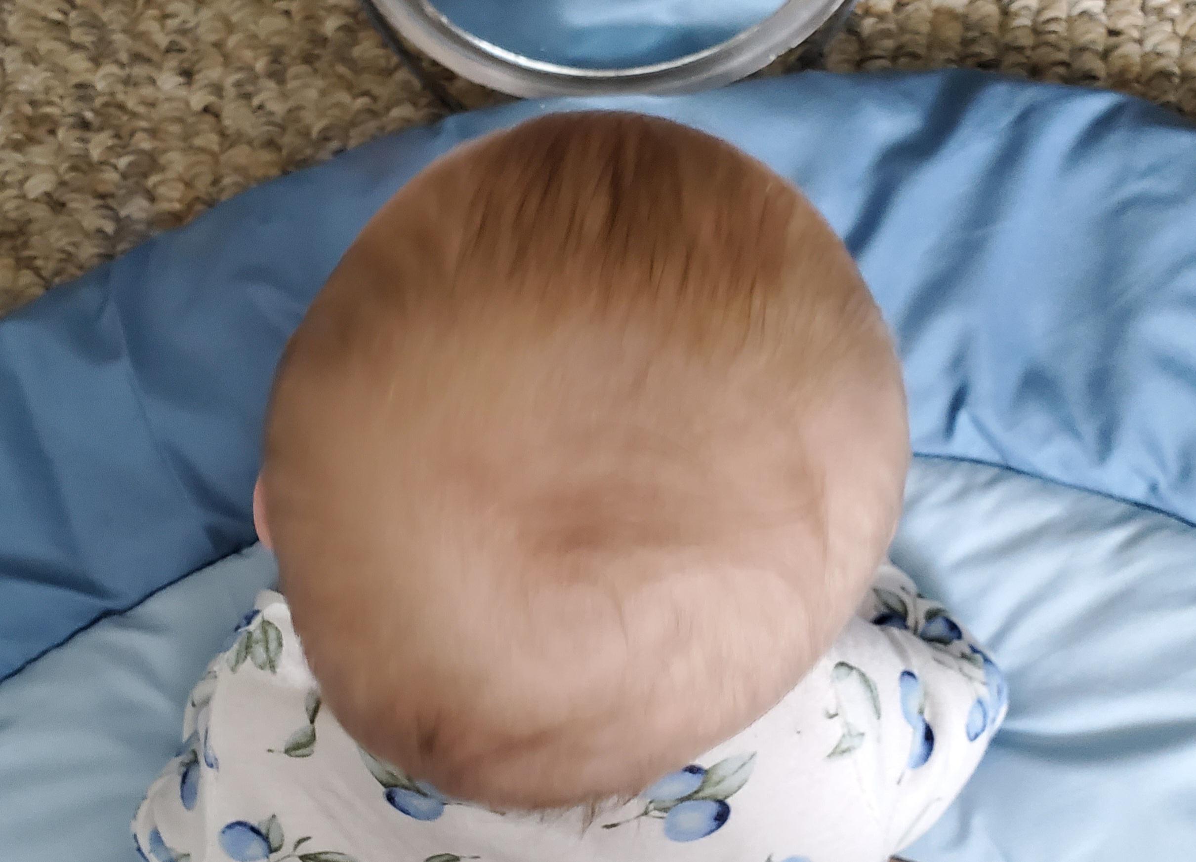 Worried about flat spot on baby's head. Everyone keeps poohpoohing me