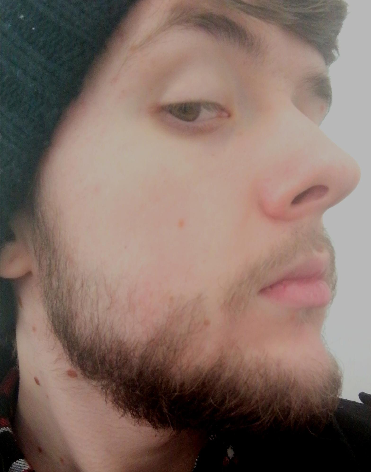 18 Year old beard, will it grow? About a month of growth. BeardAdvice
