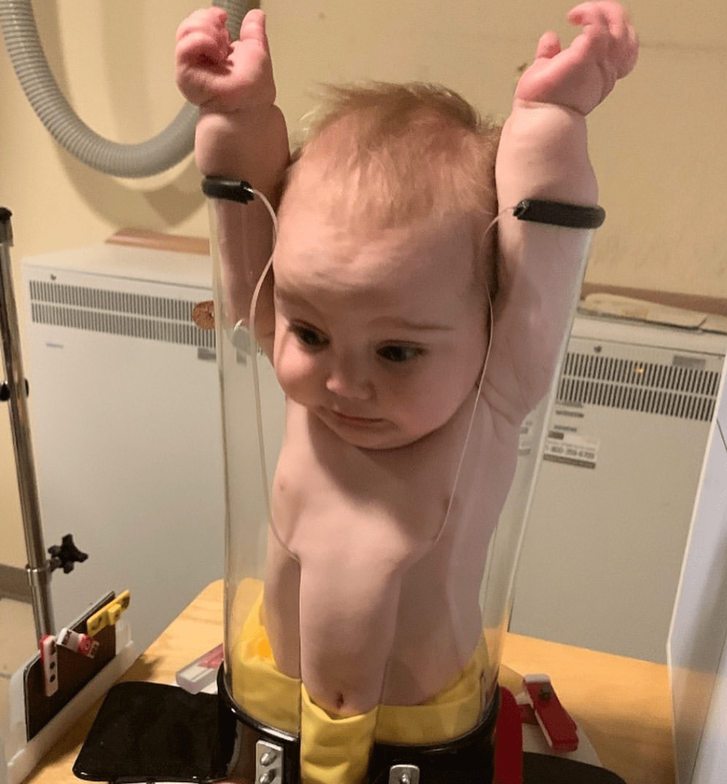 Have you ever wonder how babies get Xray done? pics