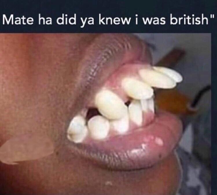 As a British person, the majority of us actually have good teeth