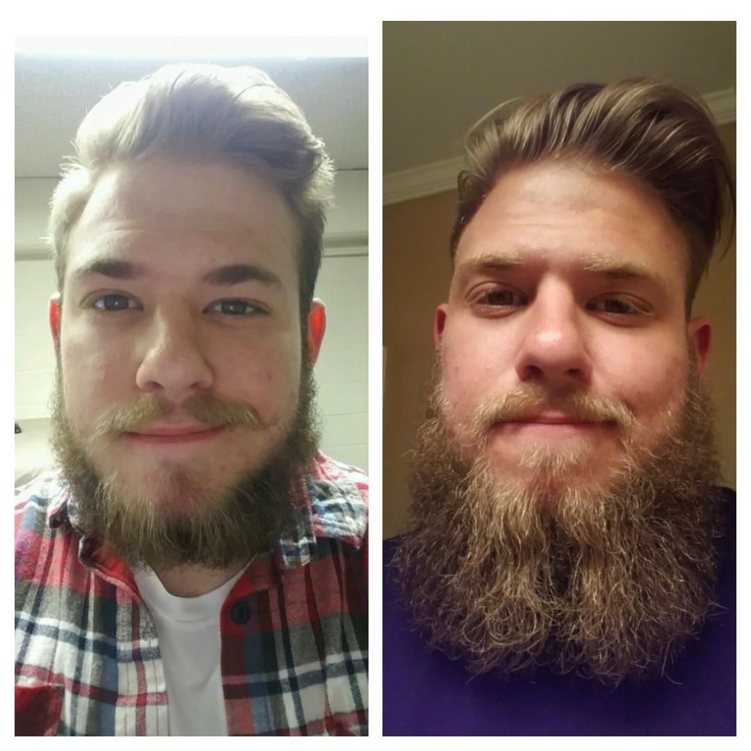 20 years old, Month 4 > Month 7 beards