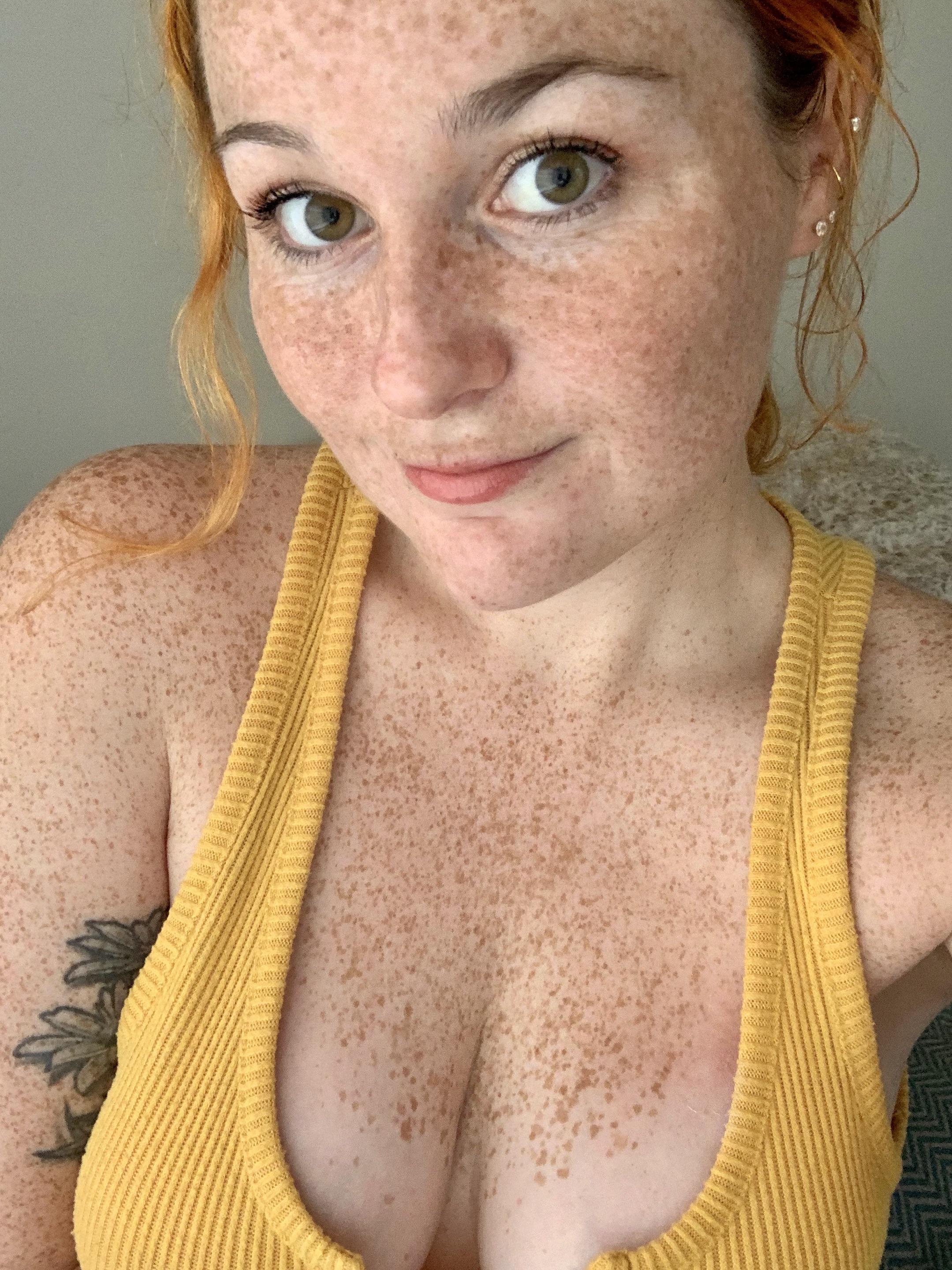 Lots of freckles for your Friday 💛 : FreckledGirls