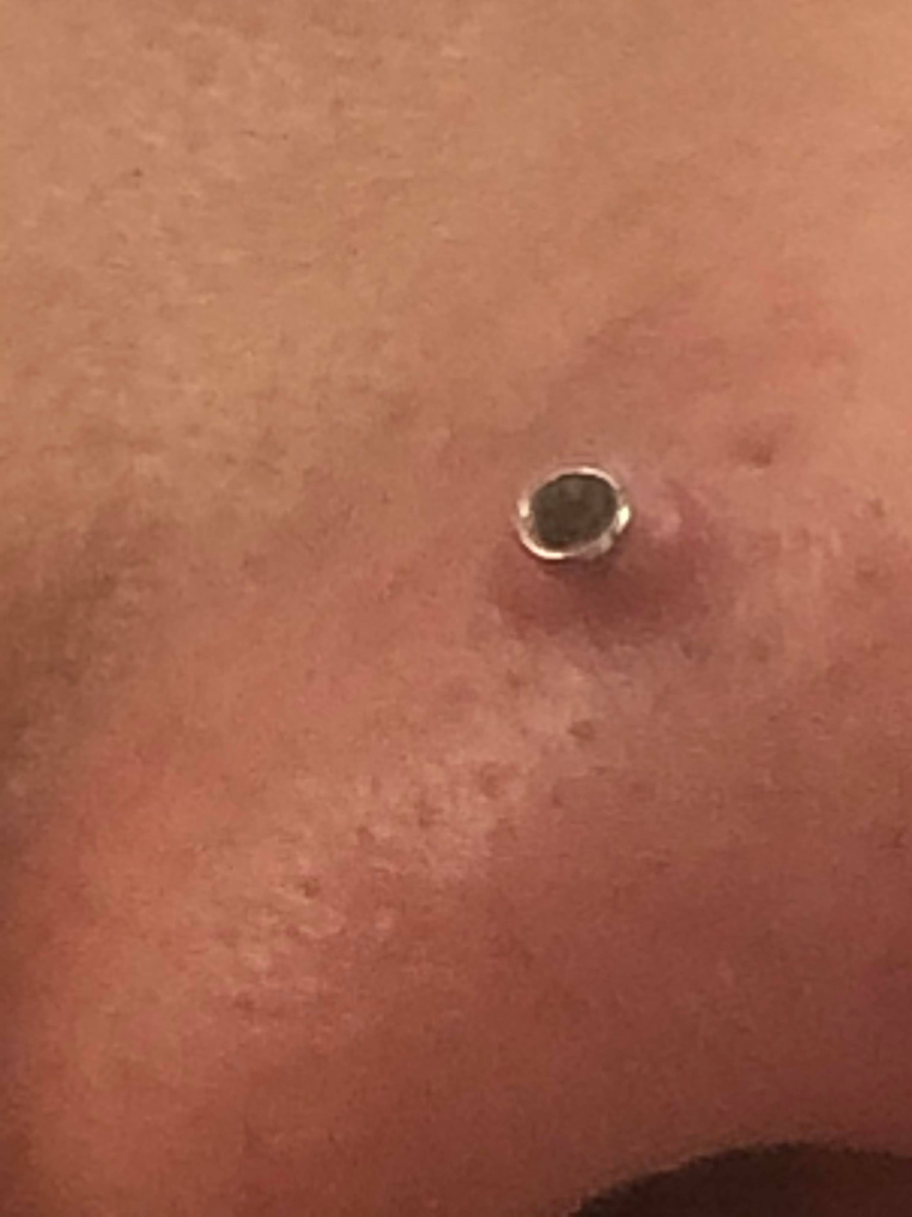 Nose piercing bump HELPPP I don’t know what to do I’ve had my nose