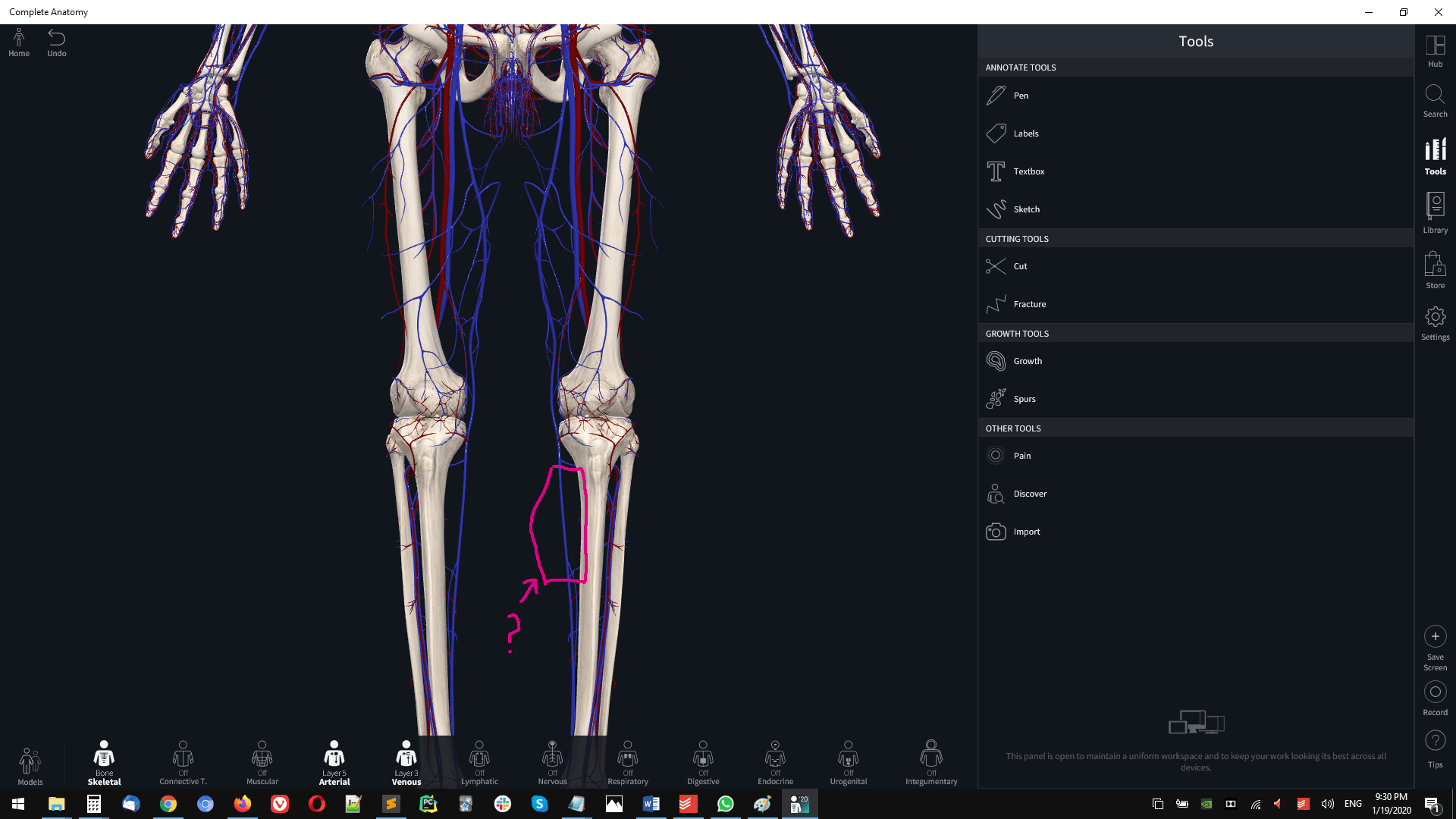 Do we just have capillaries and venules almost everywhere? For example