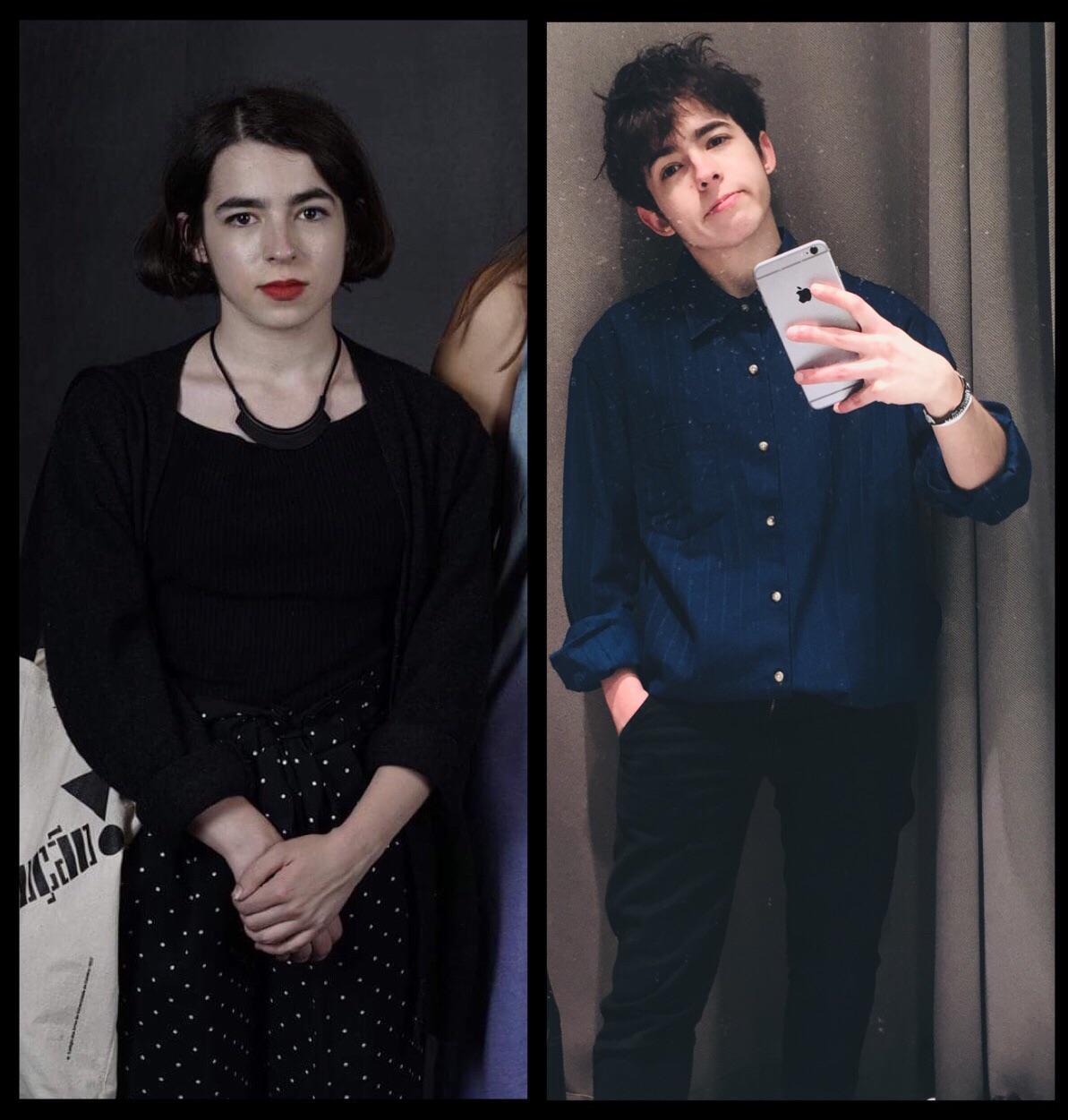 Ftm Before And After