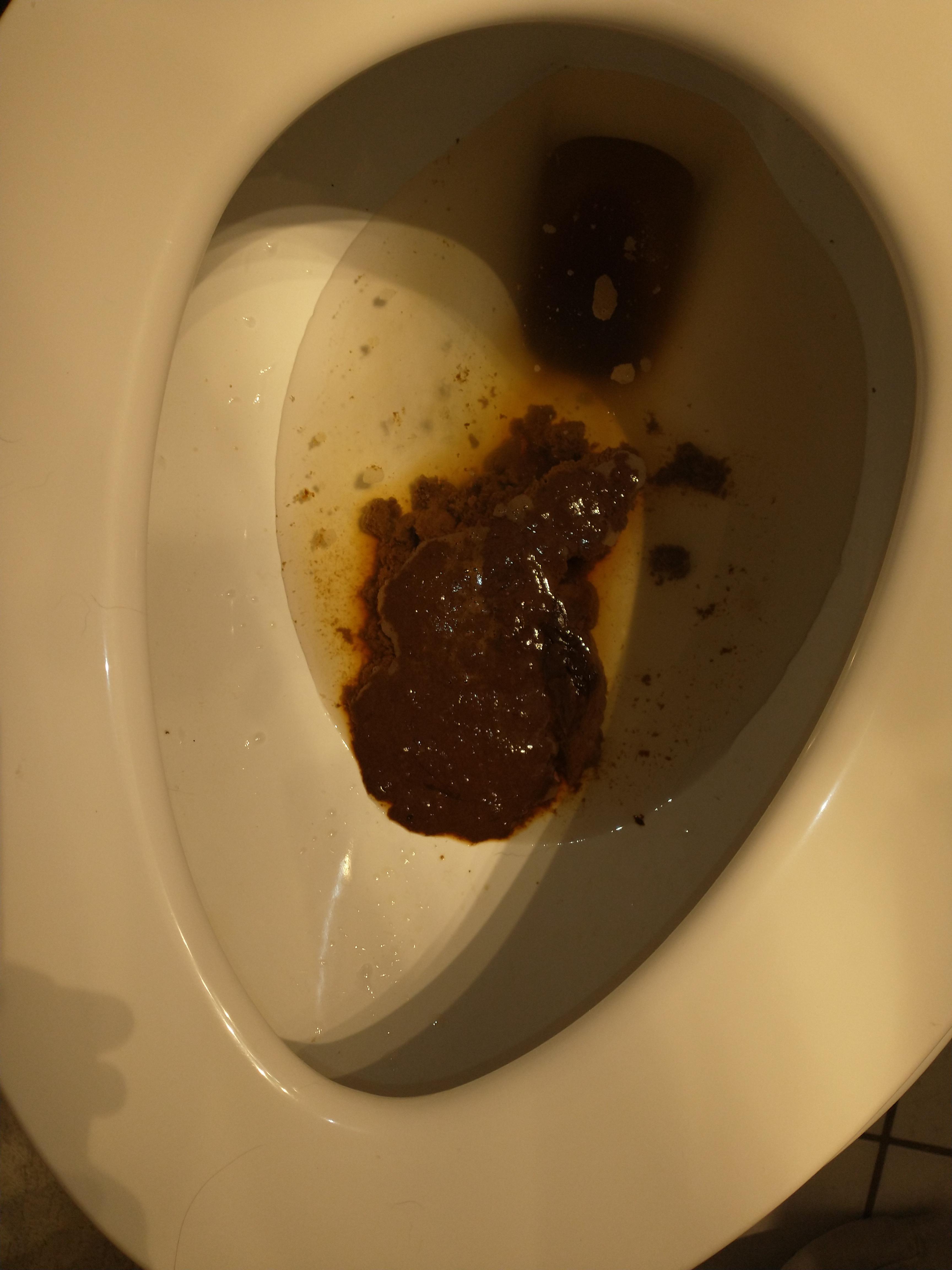 Diarrhea from a *possible* gluten allergy r/ibs