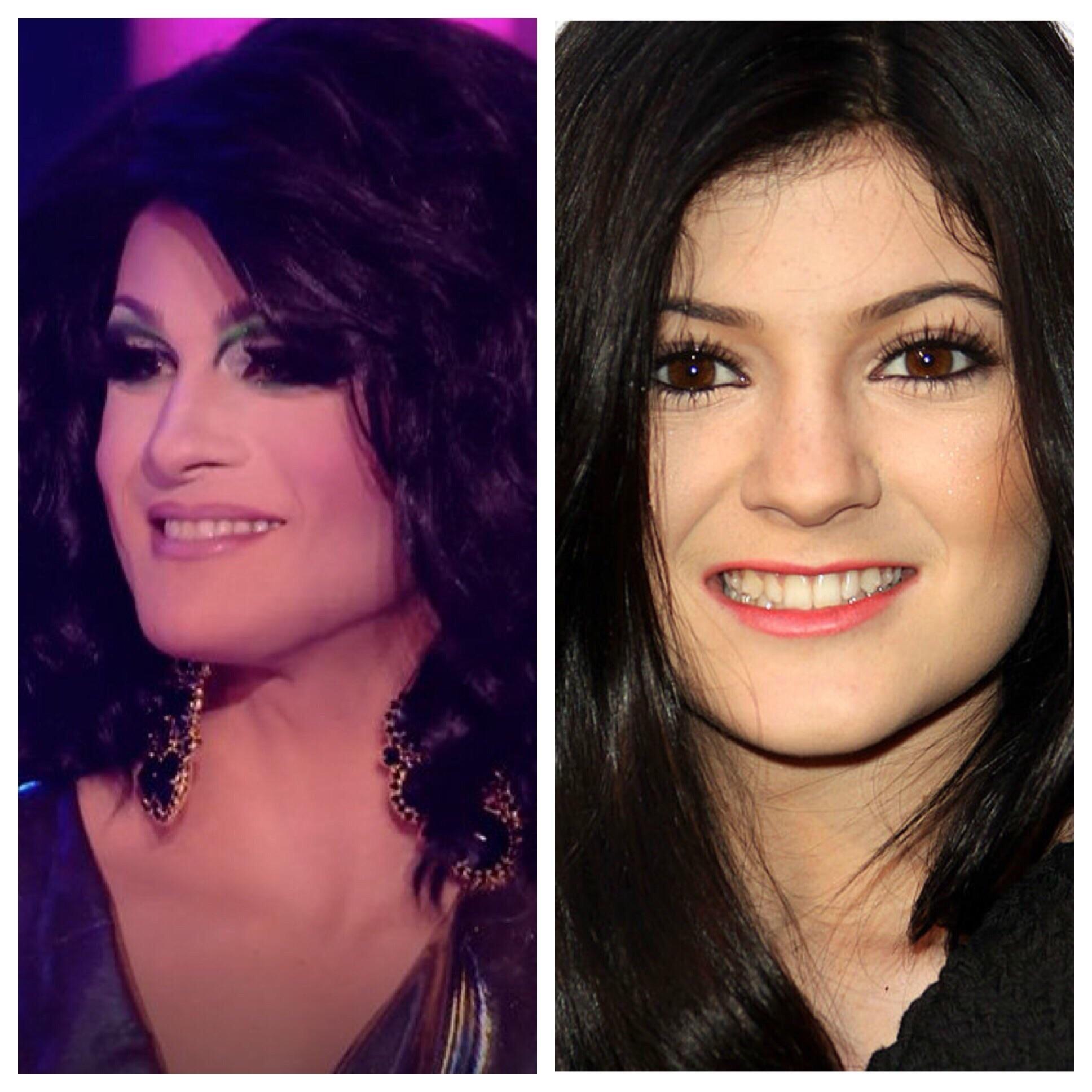 Kylie Jenner Surgery Reddit Kylie Jenner Instagram