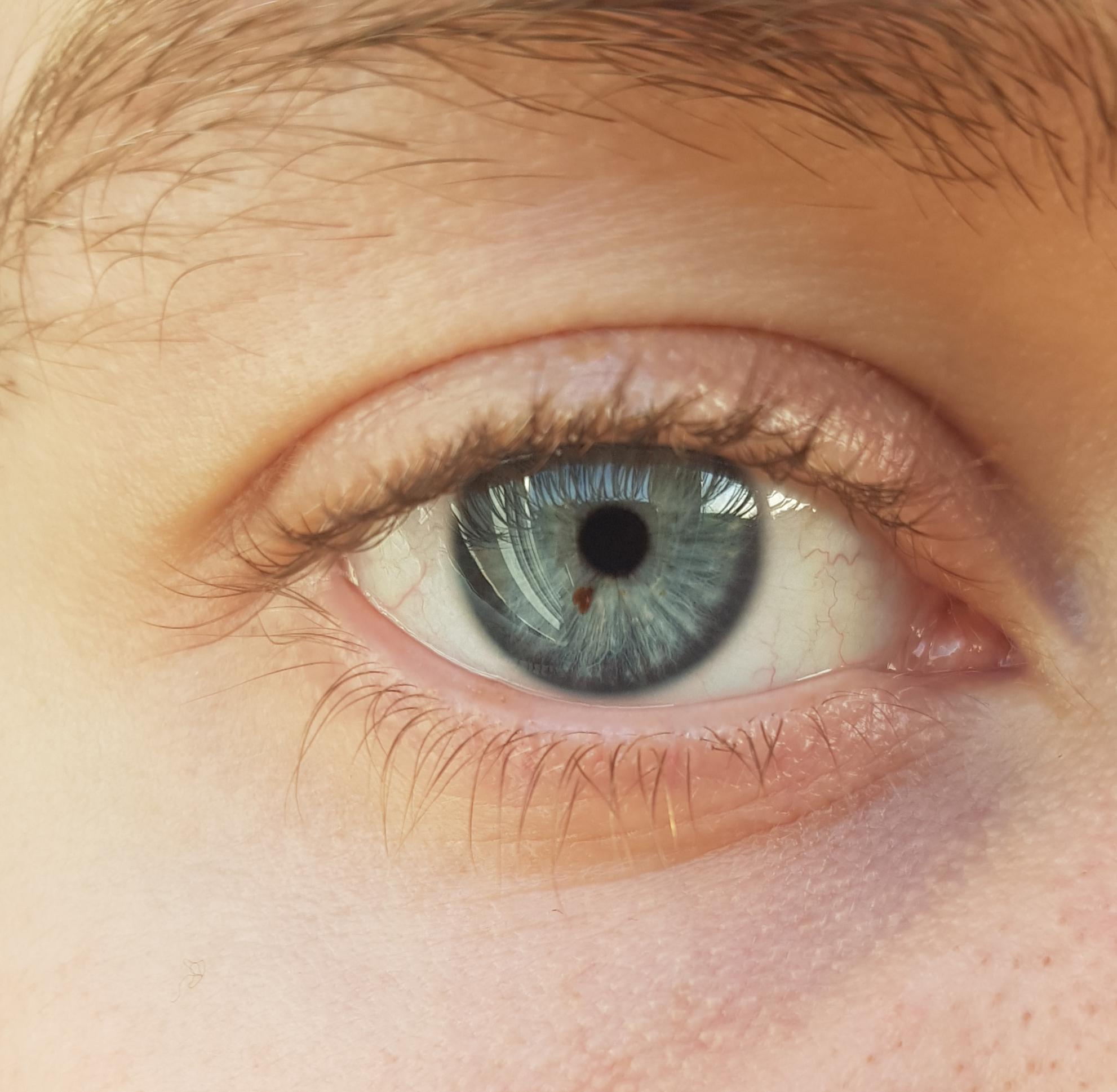 I'm sure that I've not always had this brown fleck in my right eye r/eyes