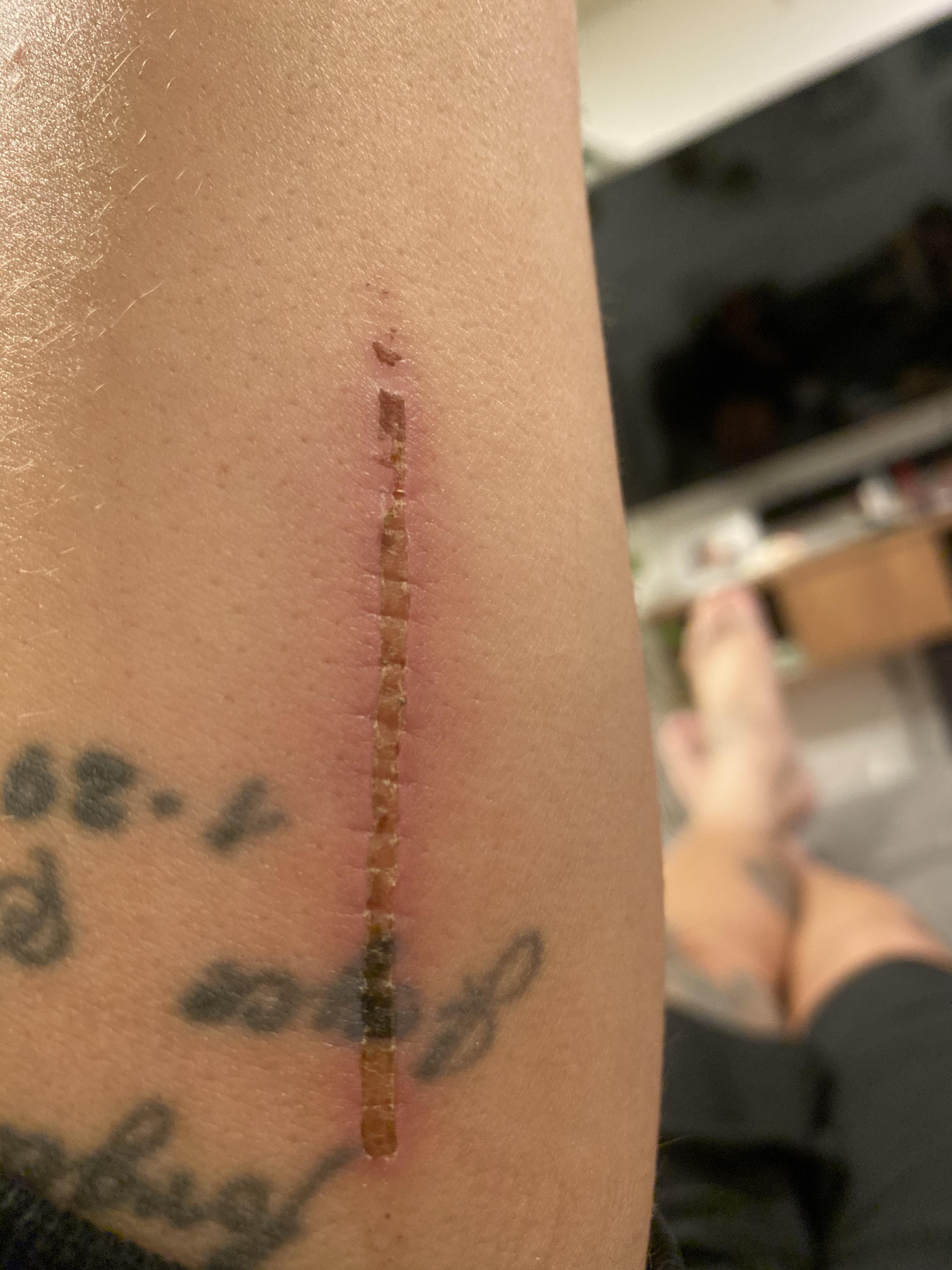 The way this scrape is healing looks like I just had stitches removed